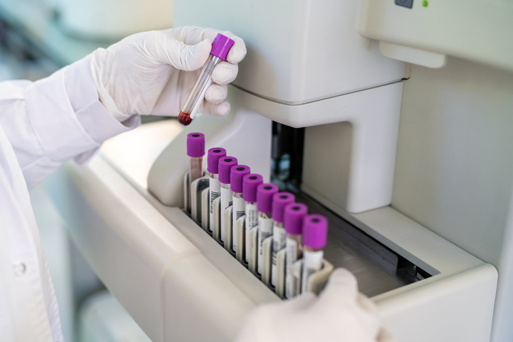 Progresso na pesquisa de microbium progride para a divulgação anterior