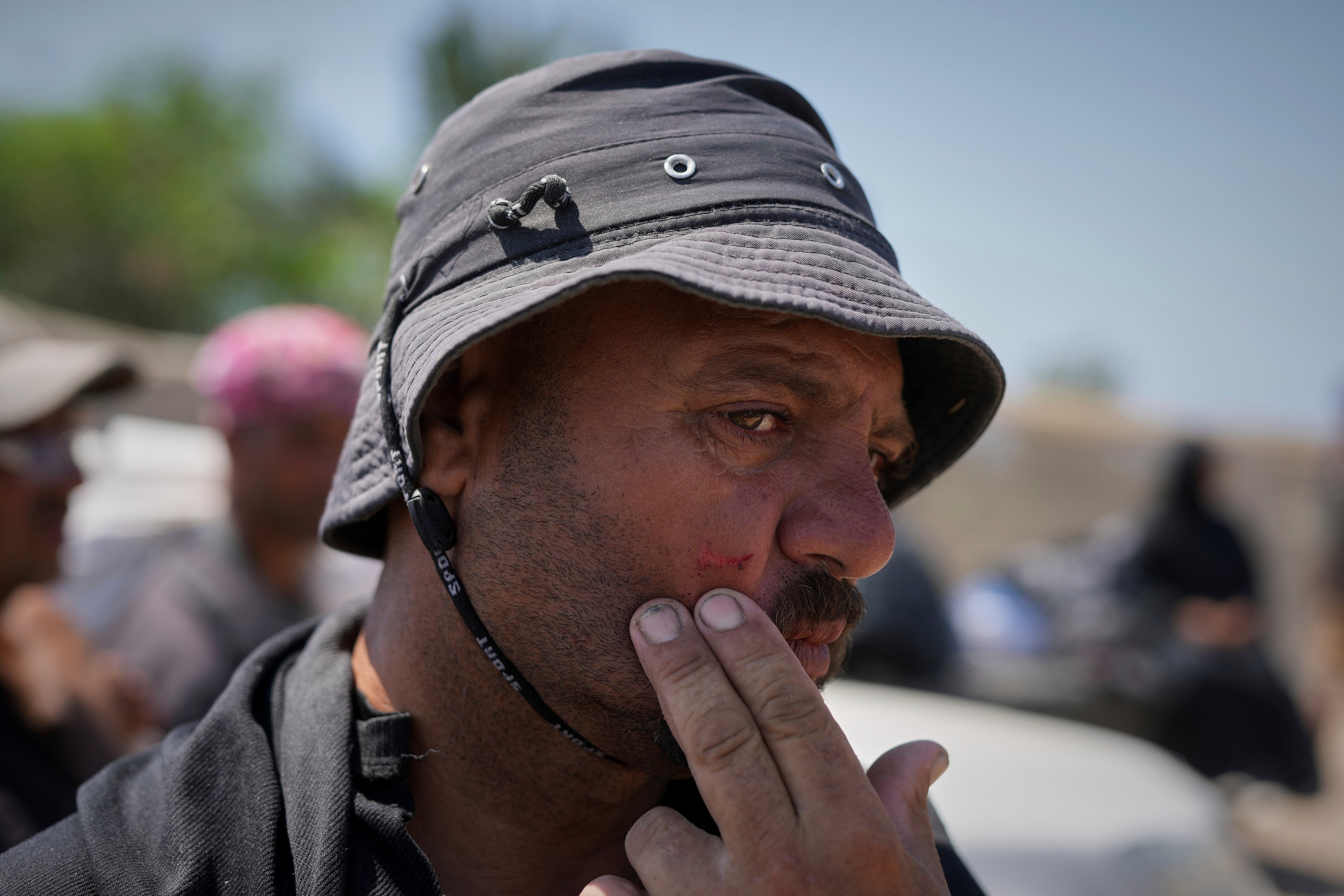 Jamil Atili, 51, shows a knife cut across his cheek, which he says he suffered amid the scramble for food at a distribution center run by private contractor the Gaza Humanitarian Foundation