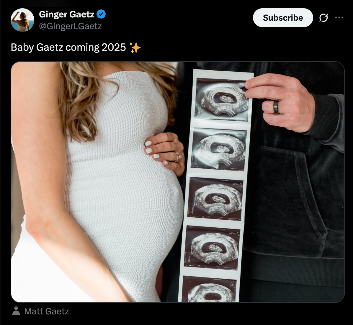 Ginger Gaetz's announced the pregnancy on X.