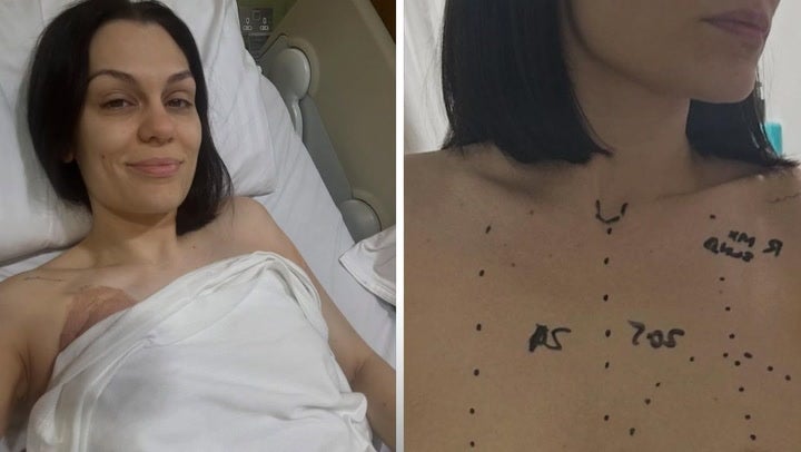 The singer previously shared a tearful update after undergoing breast cancer surgery