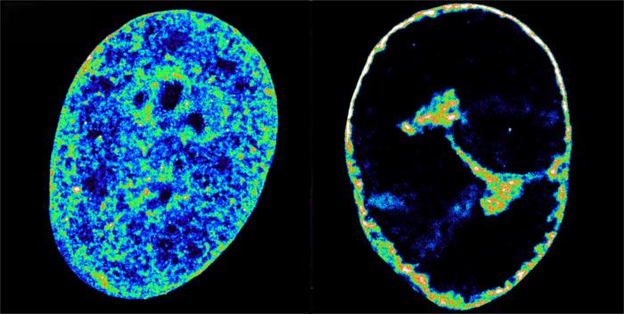 Human cells before and after herpes virus infection