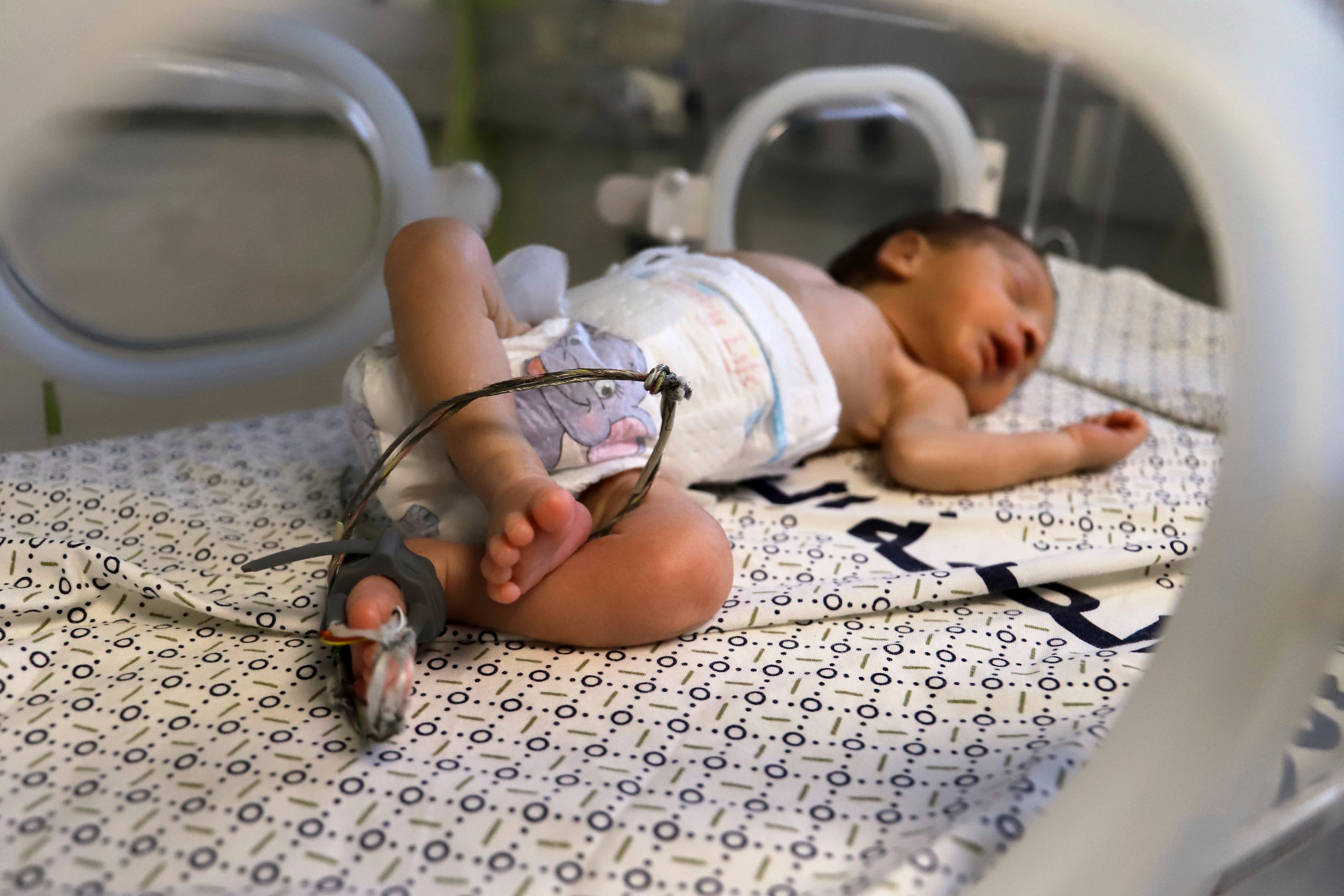 A prematurely born baby lies in an incubator in Nasser Hospital on 19 June 2025