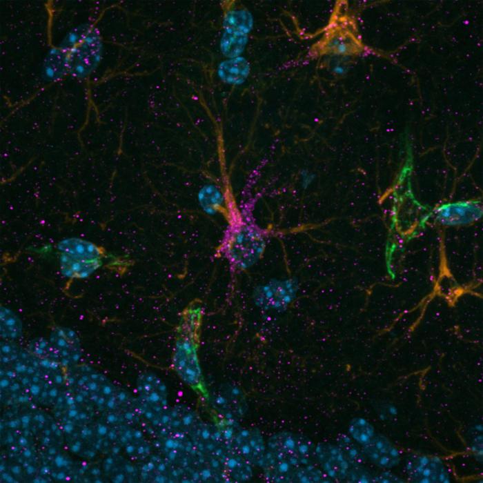 Distinct subtype of brain support cells linked to Alzheimer's