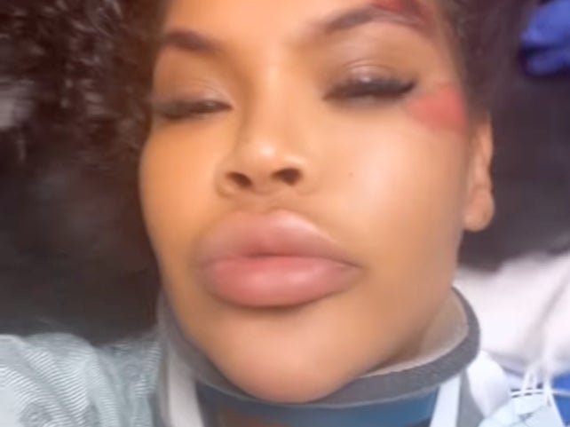 Big Brother star ‘left for dead’ after being hit by car Big Brother star ‘left for dead’ after being hit by car