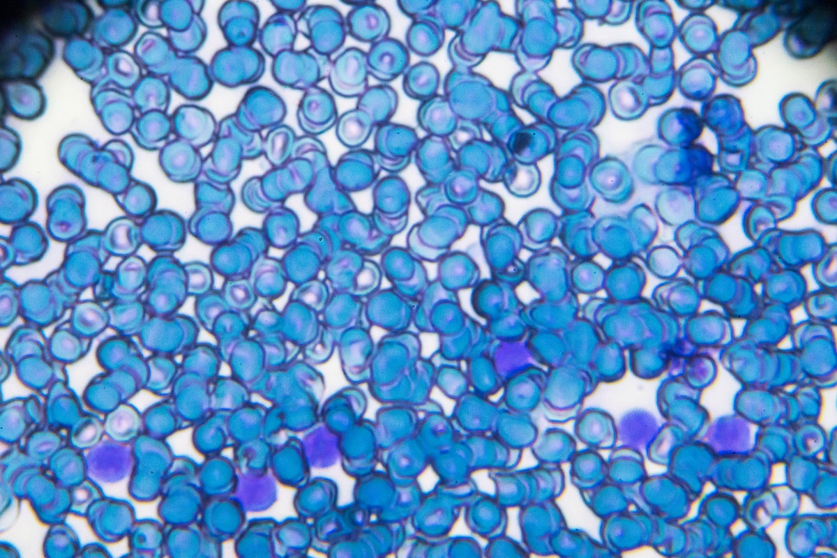 Scientists find link between where you live and childhood leukemia