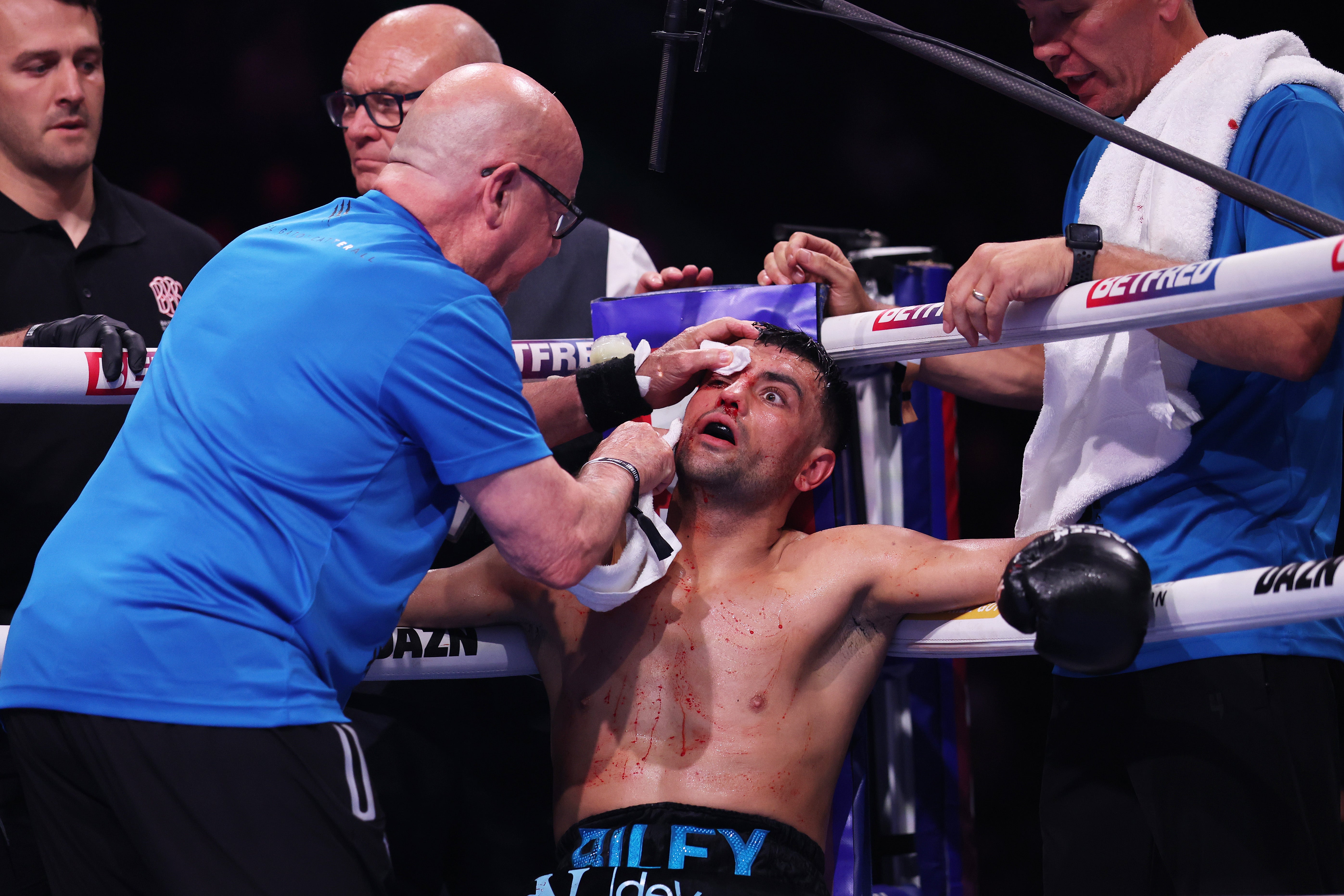 Jack Catterall receiving treatment to a cut over his eye