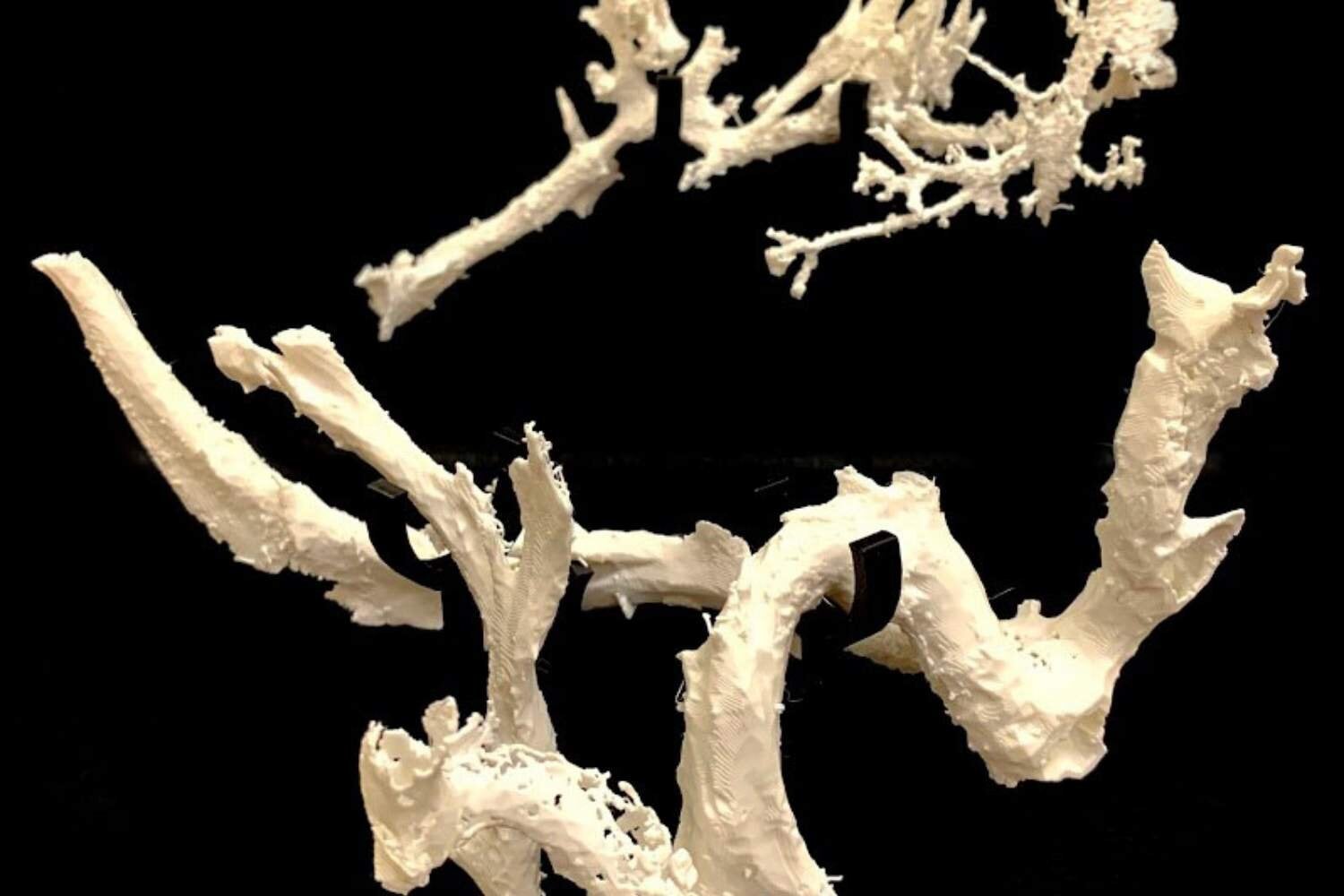 3D-printed vessel structures inside Scotty’s rib