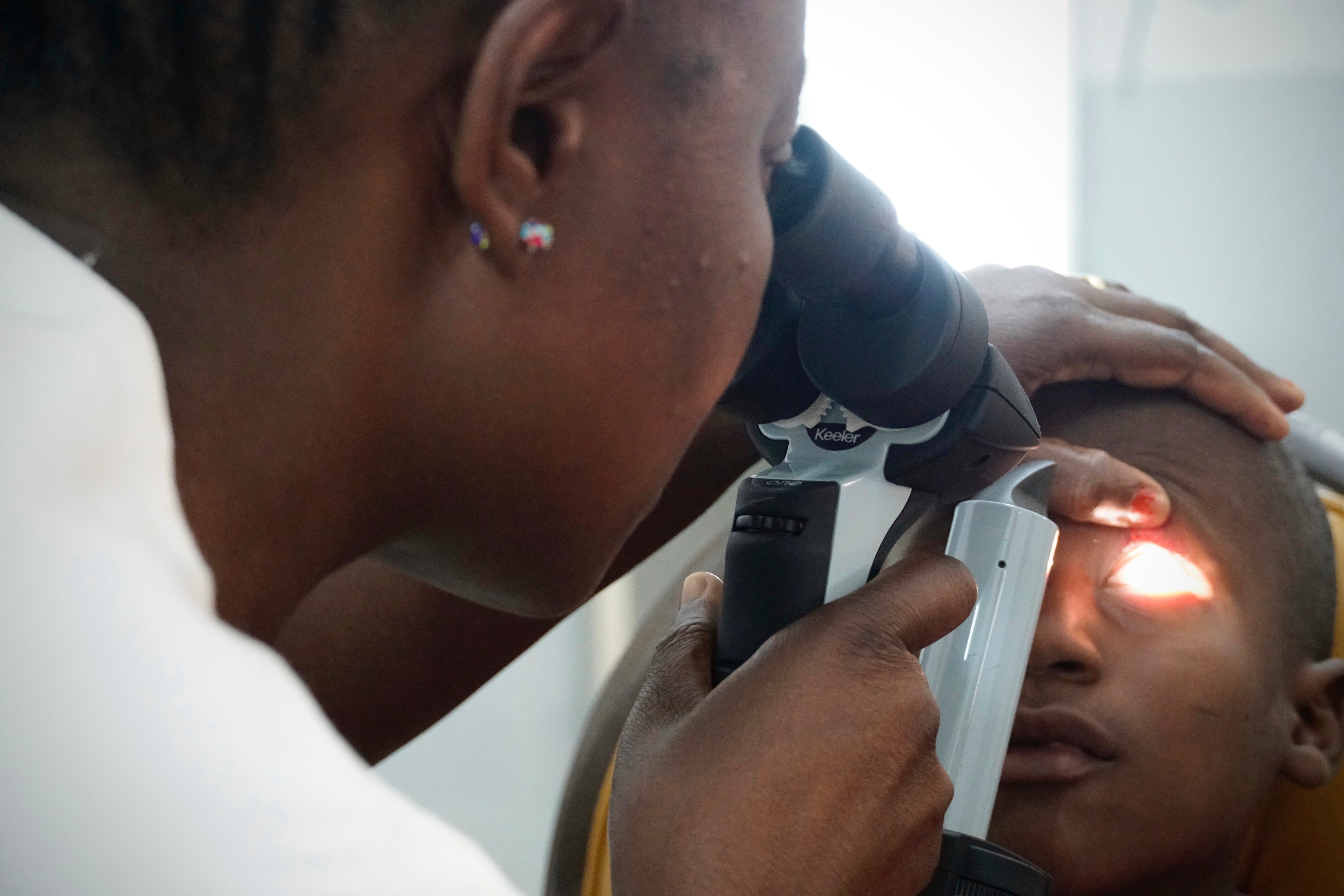 Burkina Faso Eye Doctor