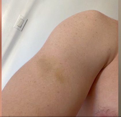 The unidentified victim shows his bruises sustained from Yagishita's attacks.