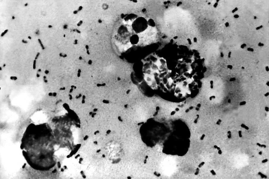 Os testes confirmaram que o paciente do Arizona tinha Yersinia pestis, as bactérias que causam peste