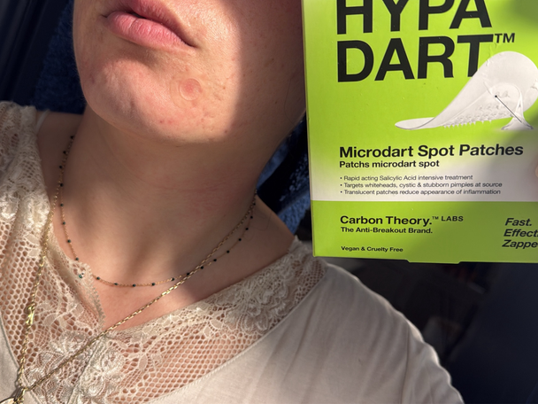 Best pimple patches IndyBest review Carbon Theory supacylic hypa dart microdart patches