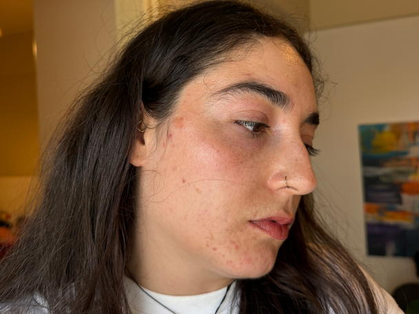 Best pimple patches IndyBest review Hero cosmetics mighty patch original