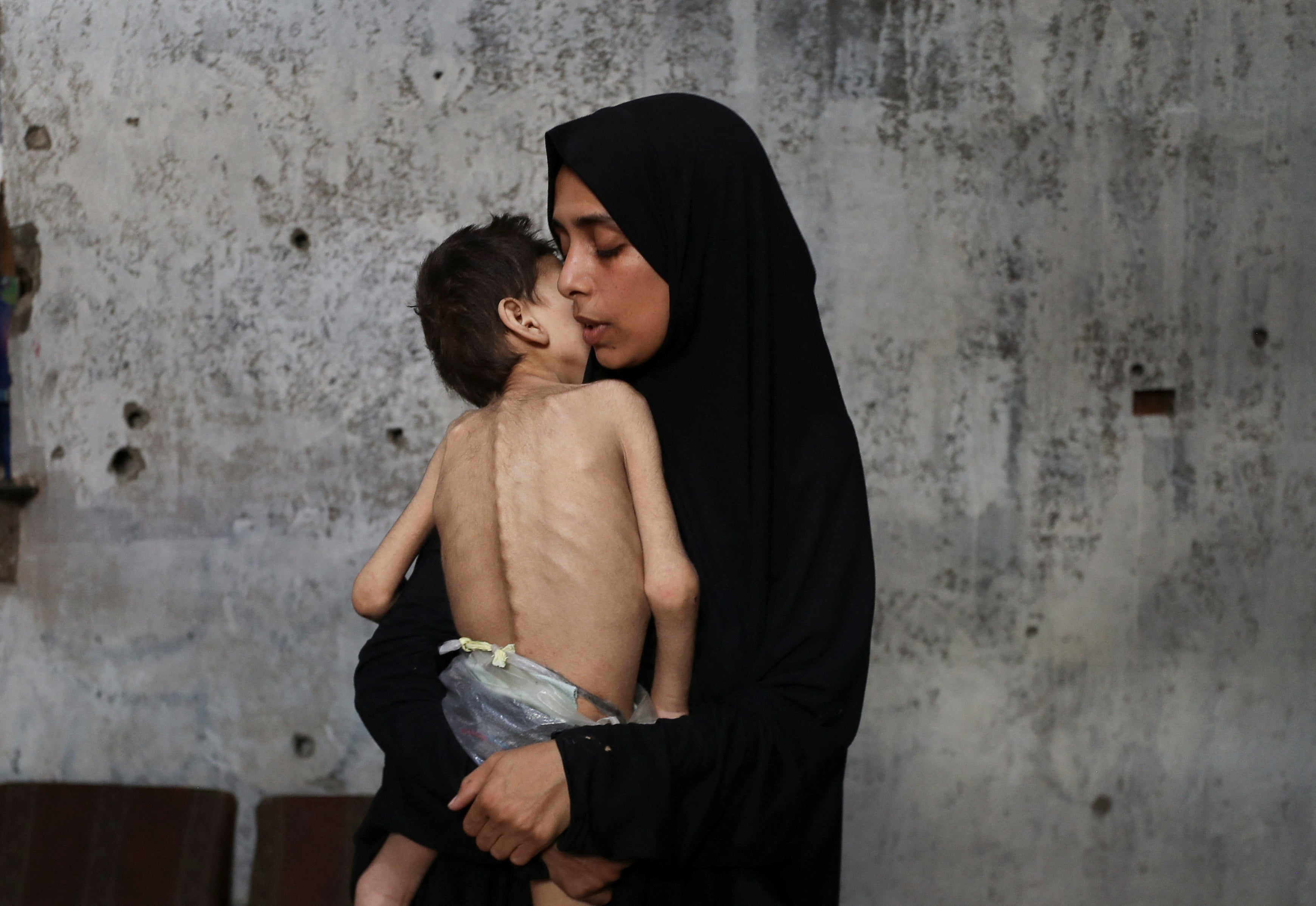 Displaced Palestinian mother Samah Matar holds her malnourished son Youssef in Gaza City