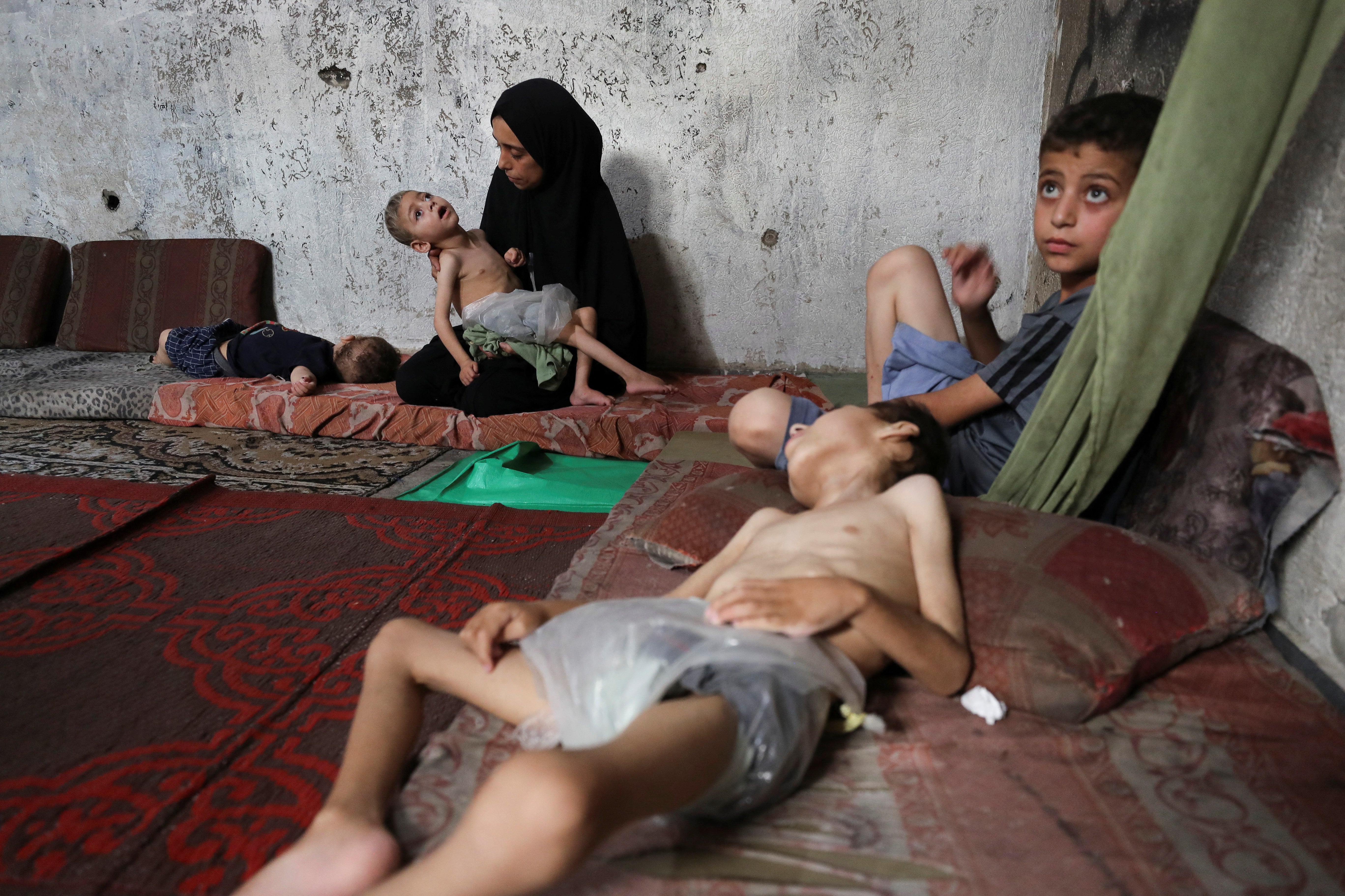 Children are dying of starvation in Gaza