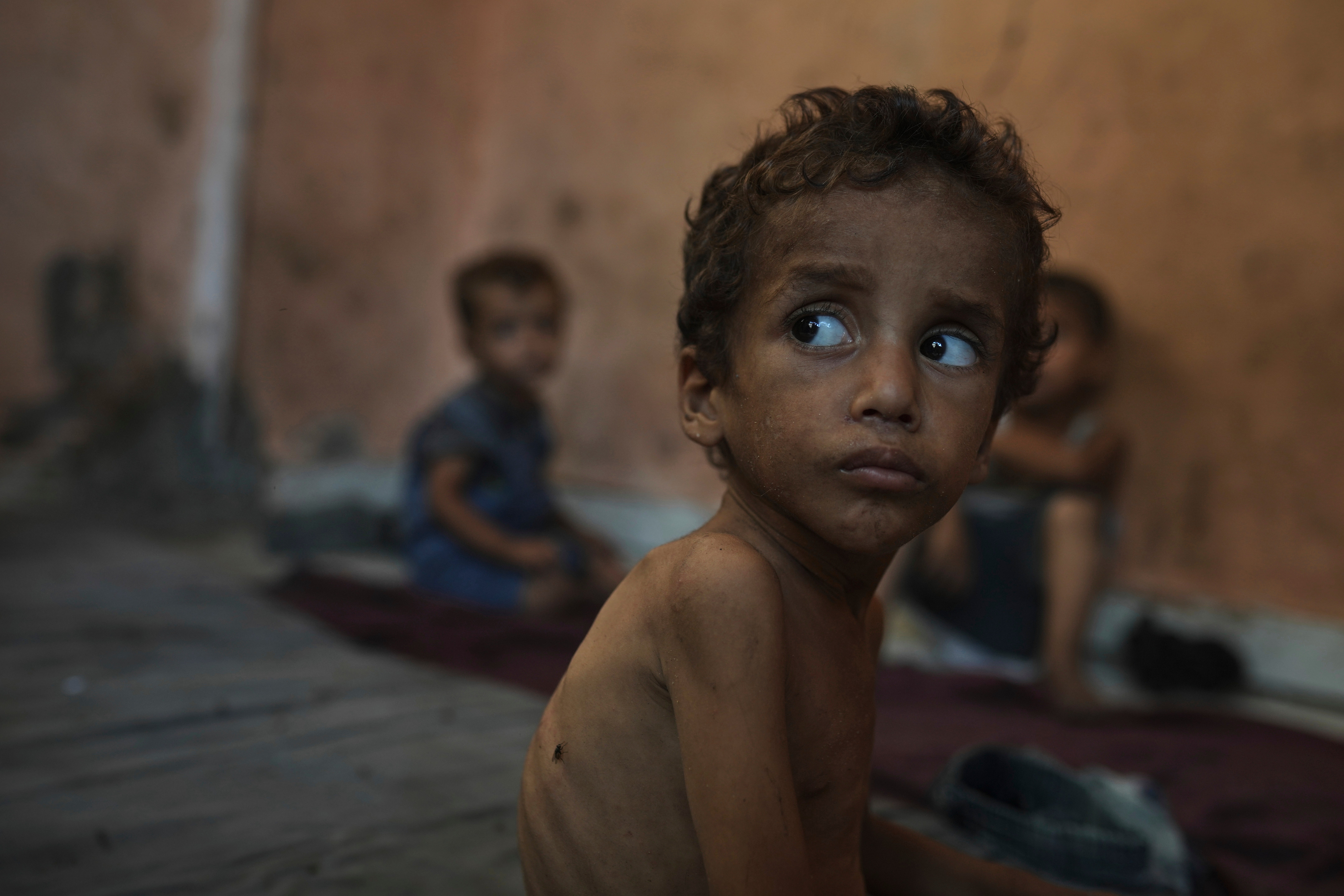 Children in Gaza are facing starvation