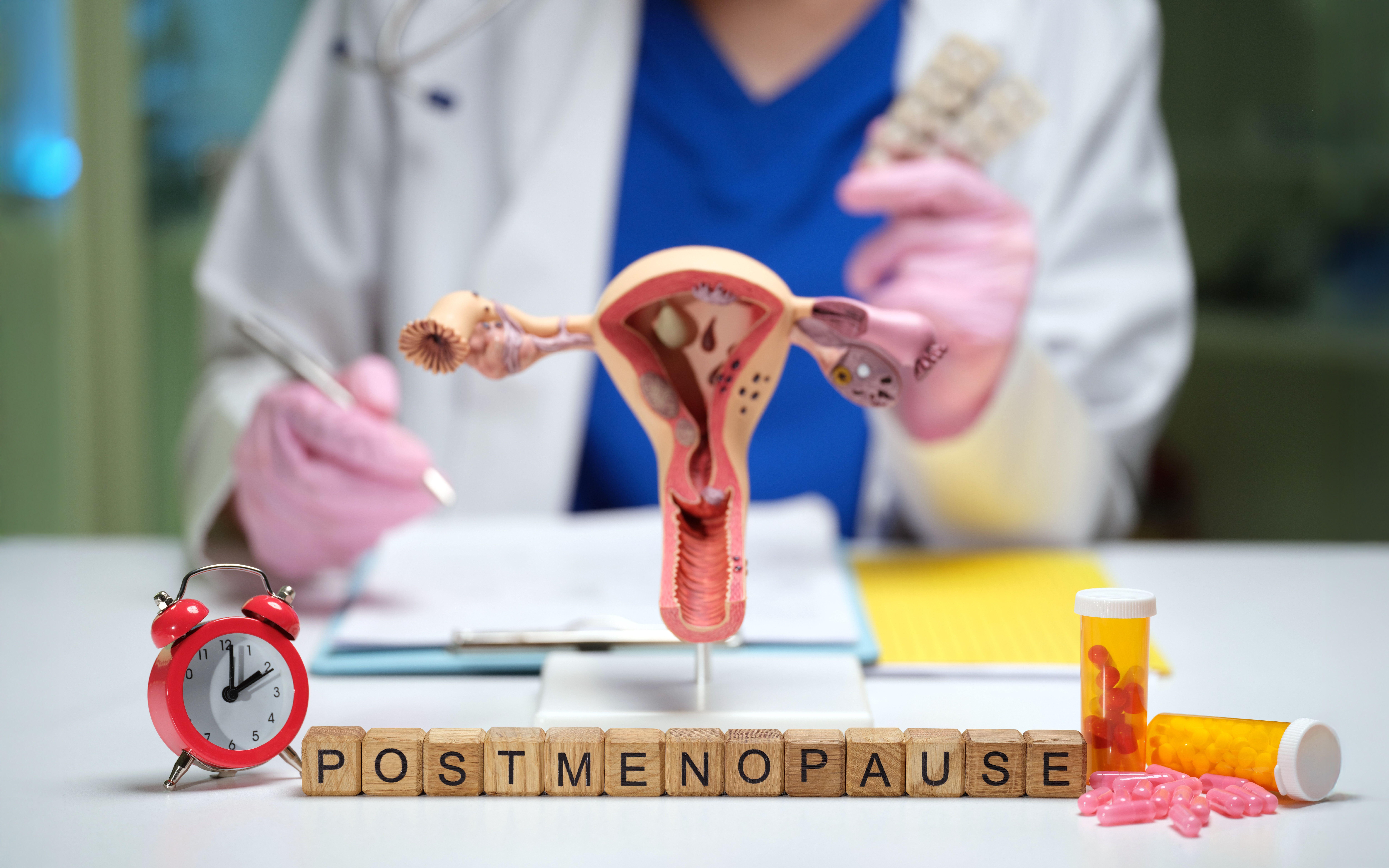 Uma mulher entra na menopausa quando teve 12 meses seguidos sem um período