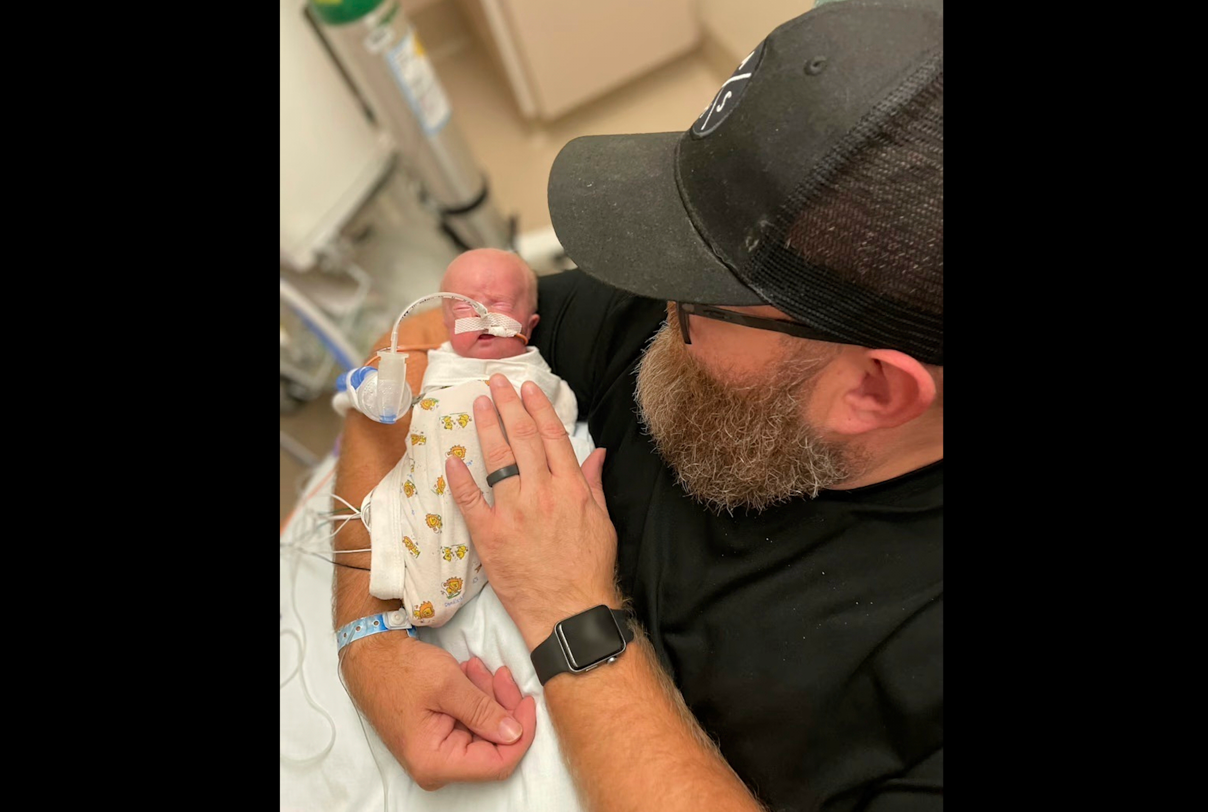 But with medical help, the Keens were able to stall the birth to exactly 21 weeks. Dad Randall Keen pictured with Nash