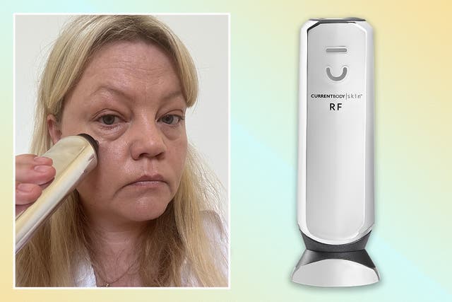 <p>The treatment combines microneedling and radiofrequency therapy</p>