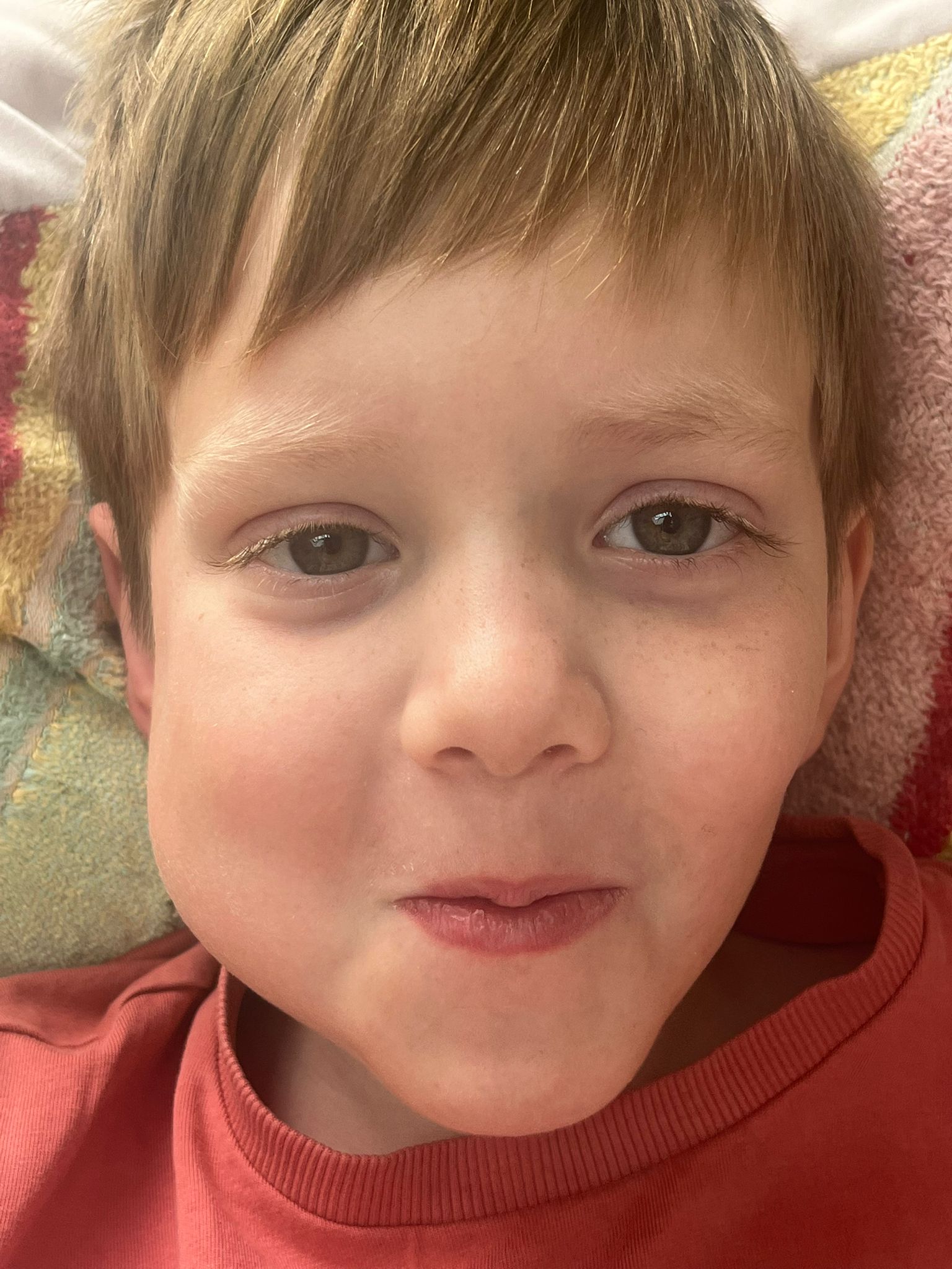 Freddieho čelist se zvětšila „jako křeček na tvář“