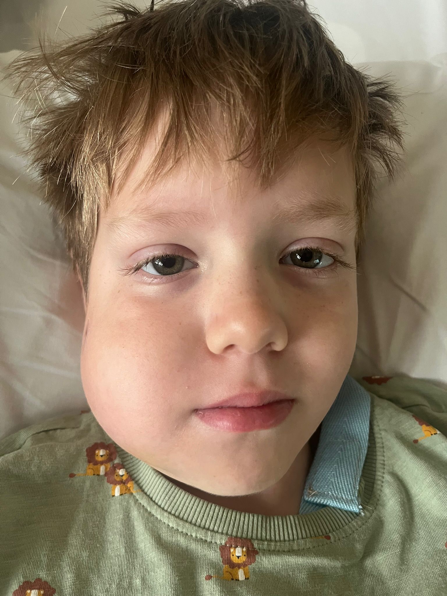 Freddie si poprvé stěžoval na kolísavý zub v květnu