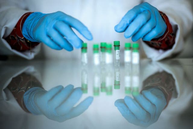 <p>Nail clubbing, often a late-stage lung cancer sign, can also indicate other serious conditions such as chronic lung infections, heart defects, gastrointestinal diseases, and autoimmune disorders, Dr.  Davood Johari said.</p>