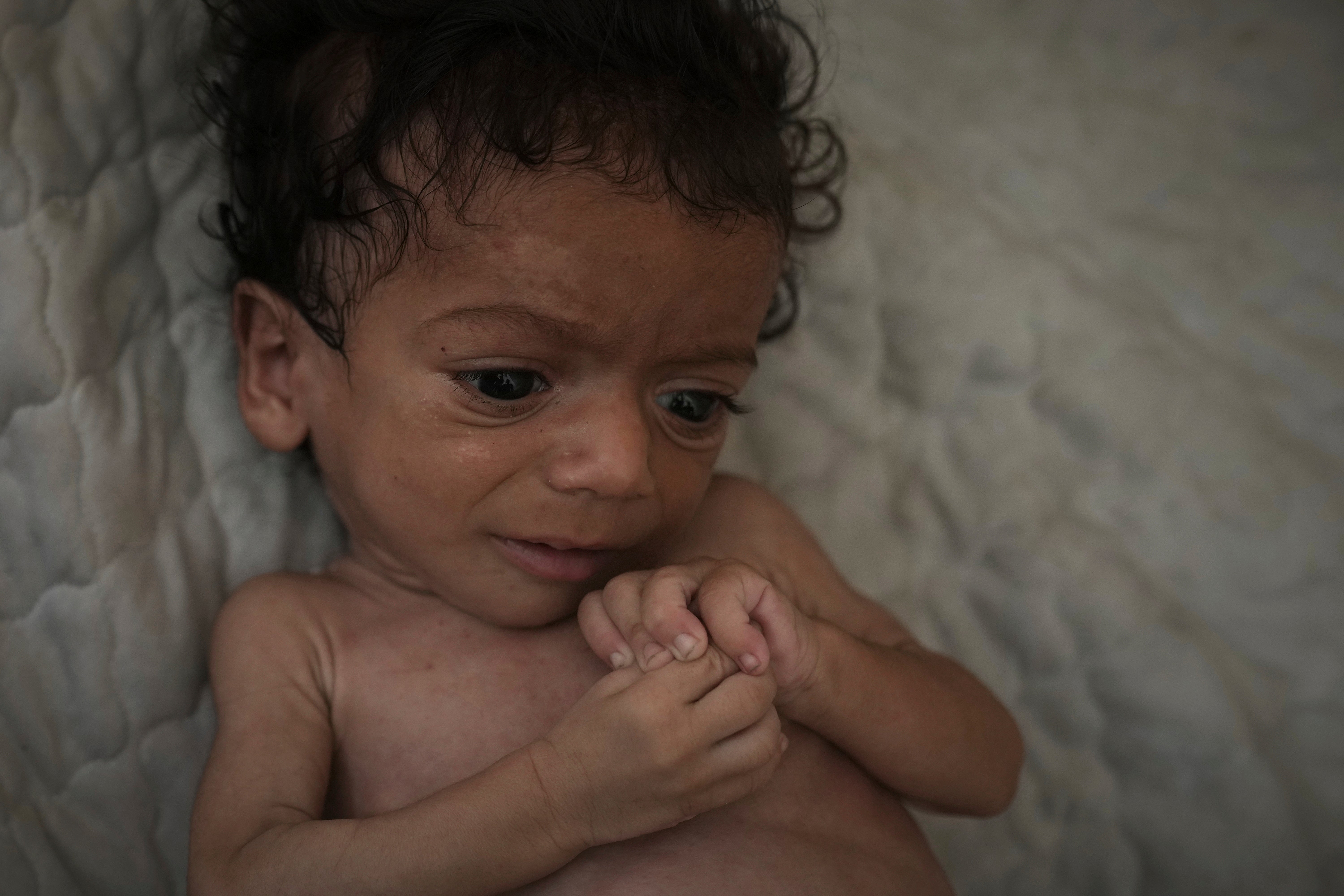 Mideast Wars Gaza Starvation Photo Essay