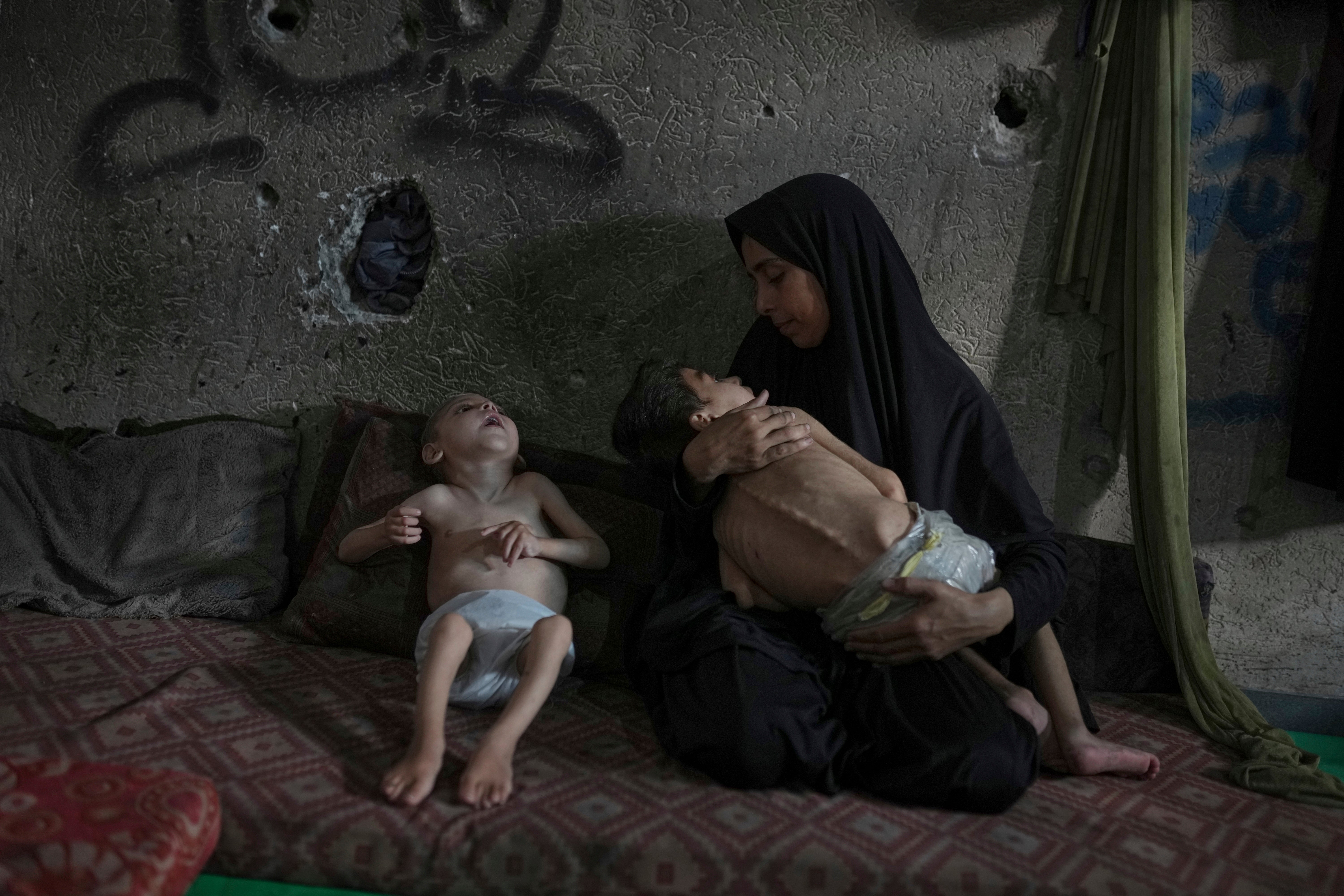 Mideast Wars Gaza Starvation Photo Essay