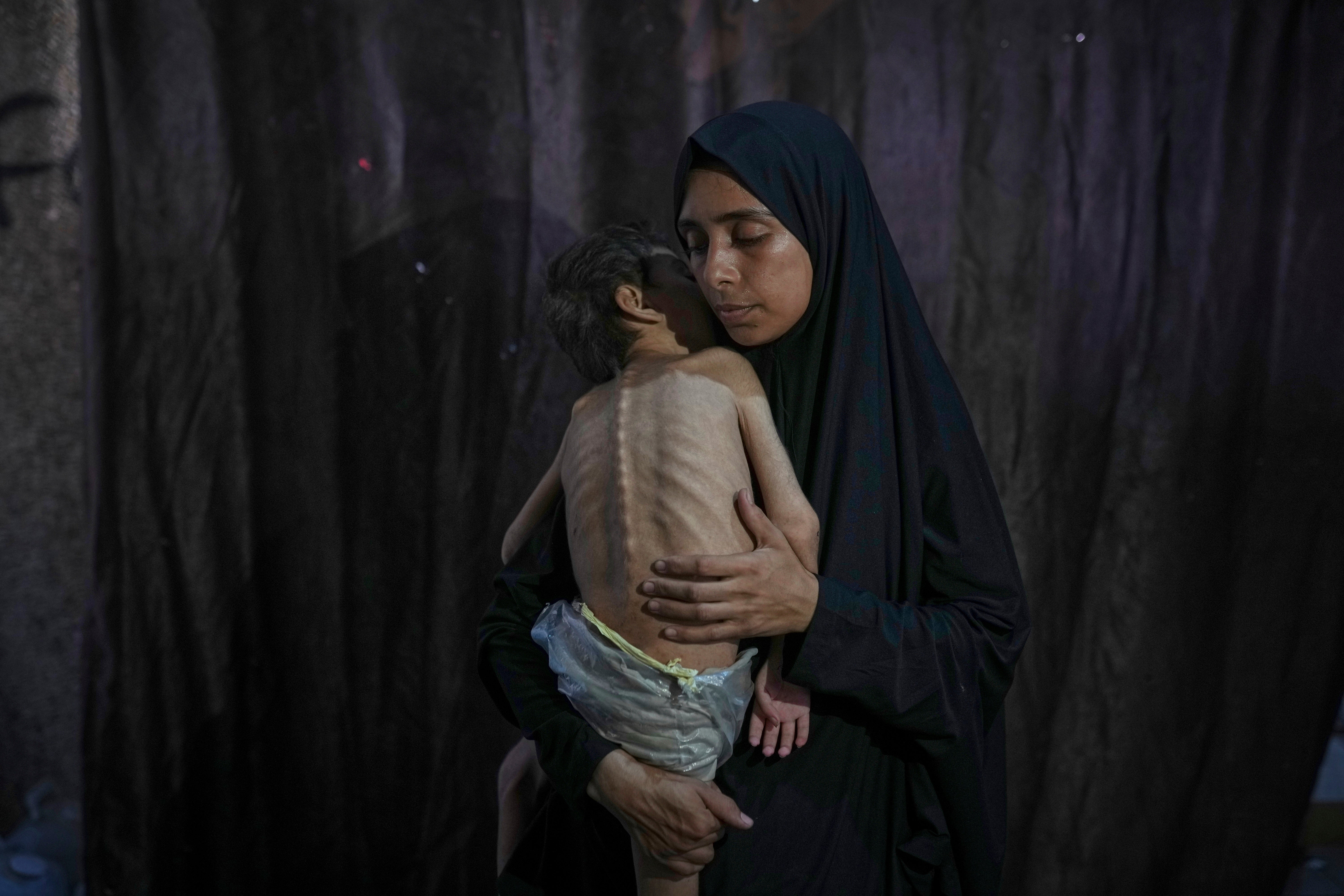 Mideast Wars Gaza Starvation Photo Essay