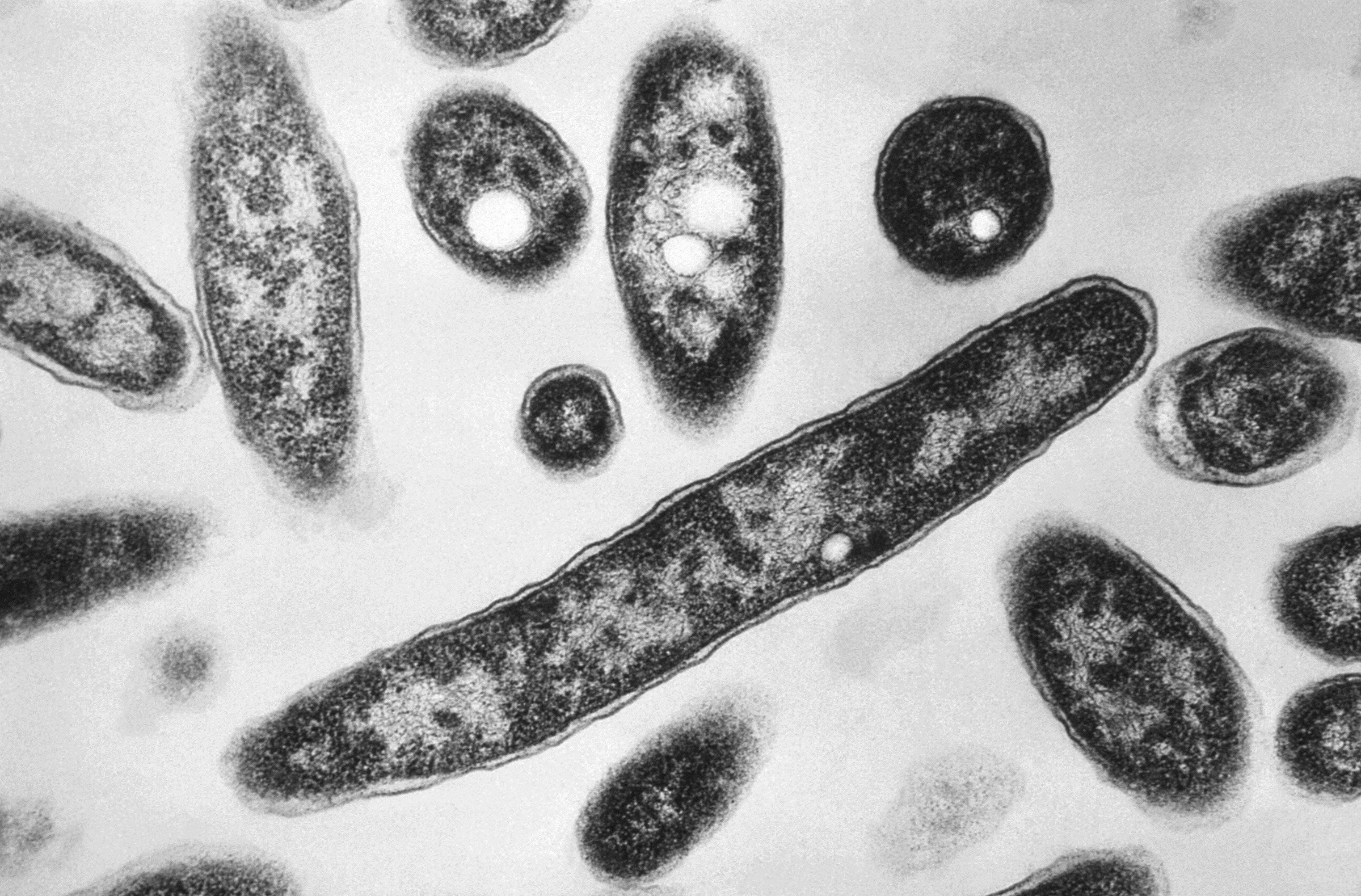 Legionella pneumophila bacteria, responsible for causing Legionnaires' disease
