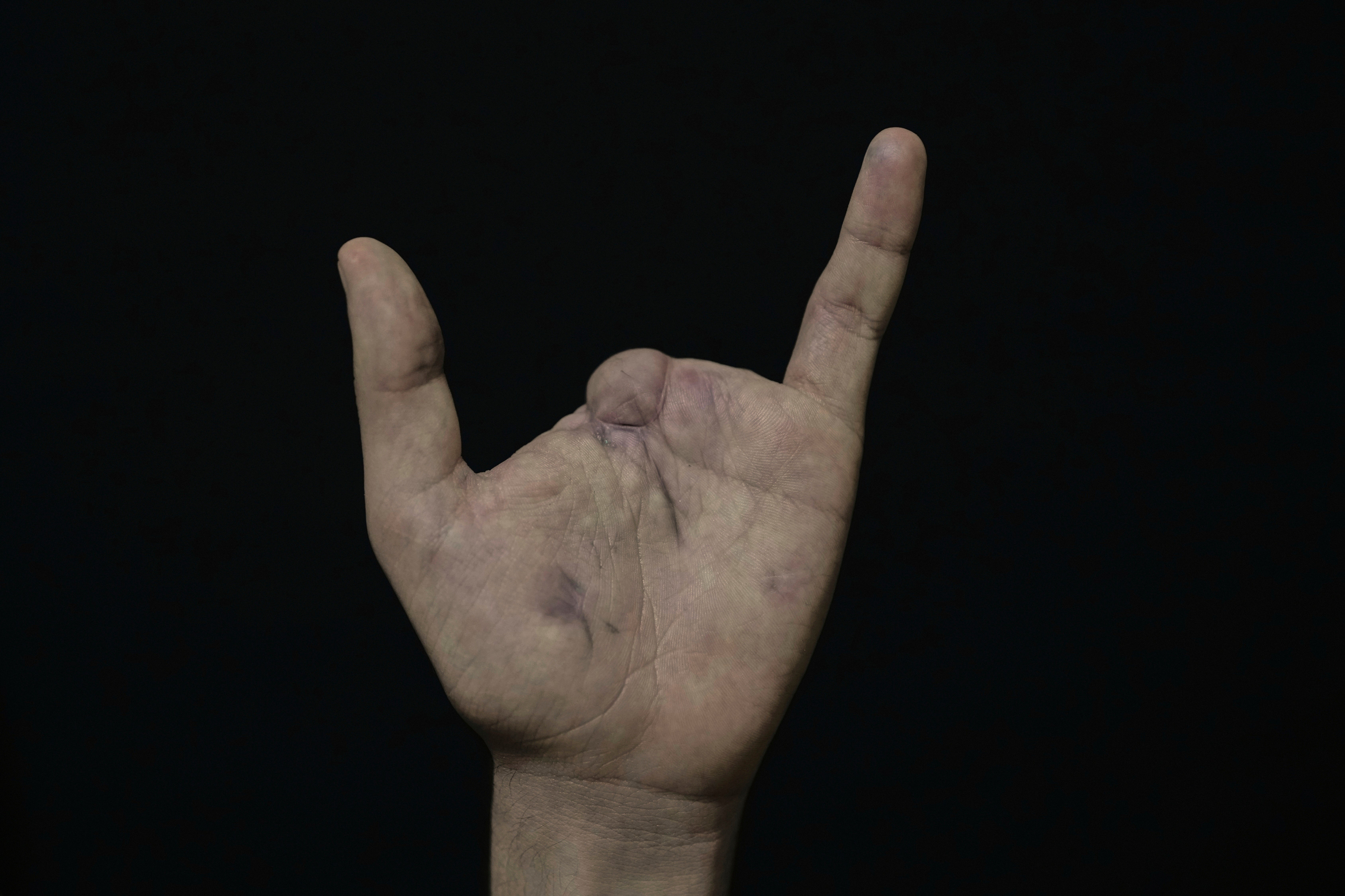 Lebanon Pager Attack Survivors Photo Essay