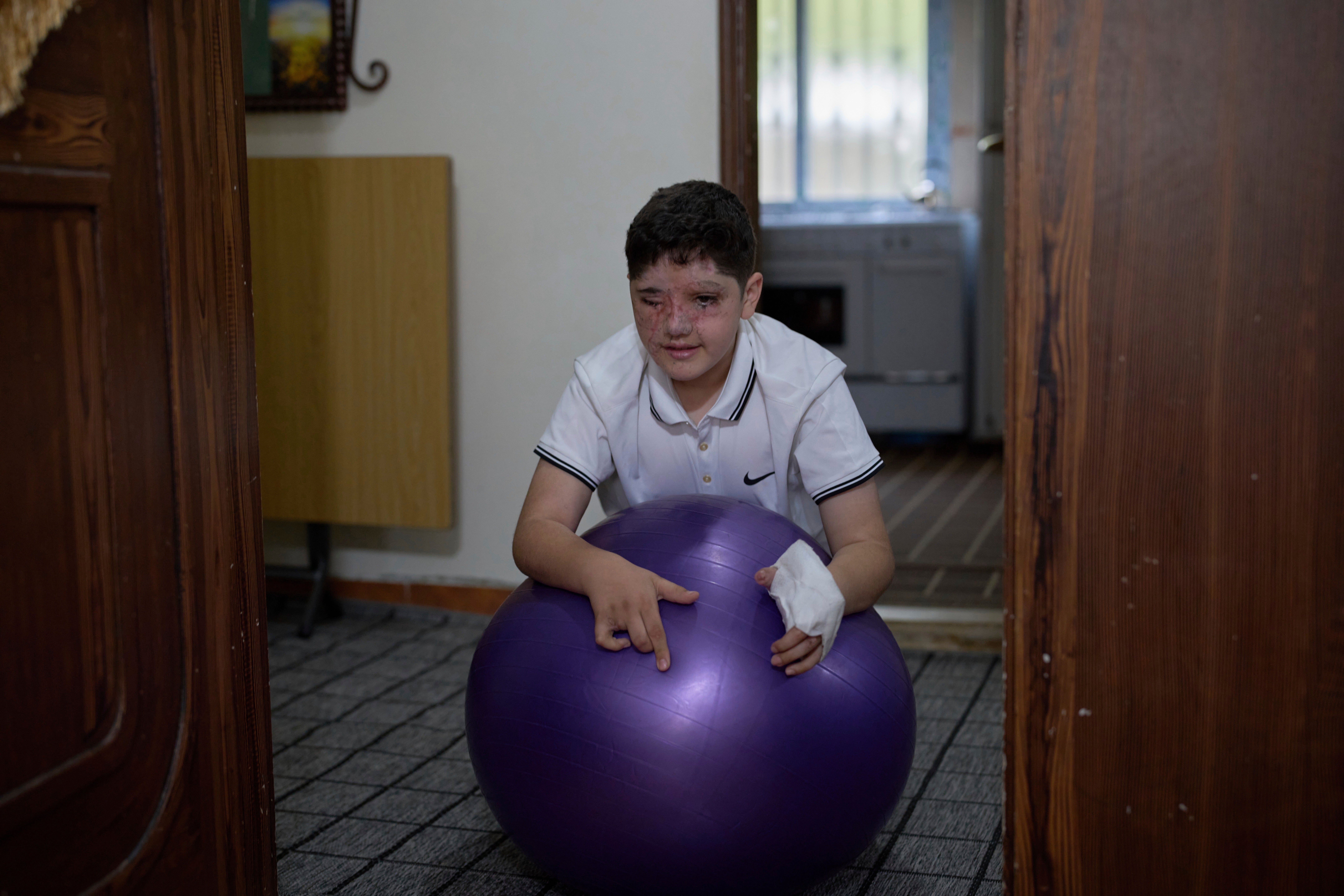 Mideast Wars Lebanon Pager Attack Survivors