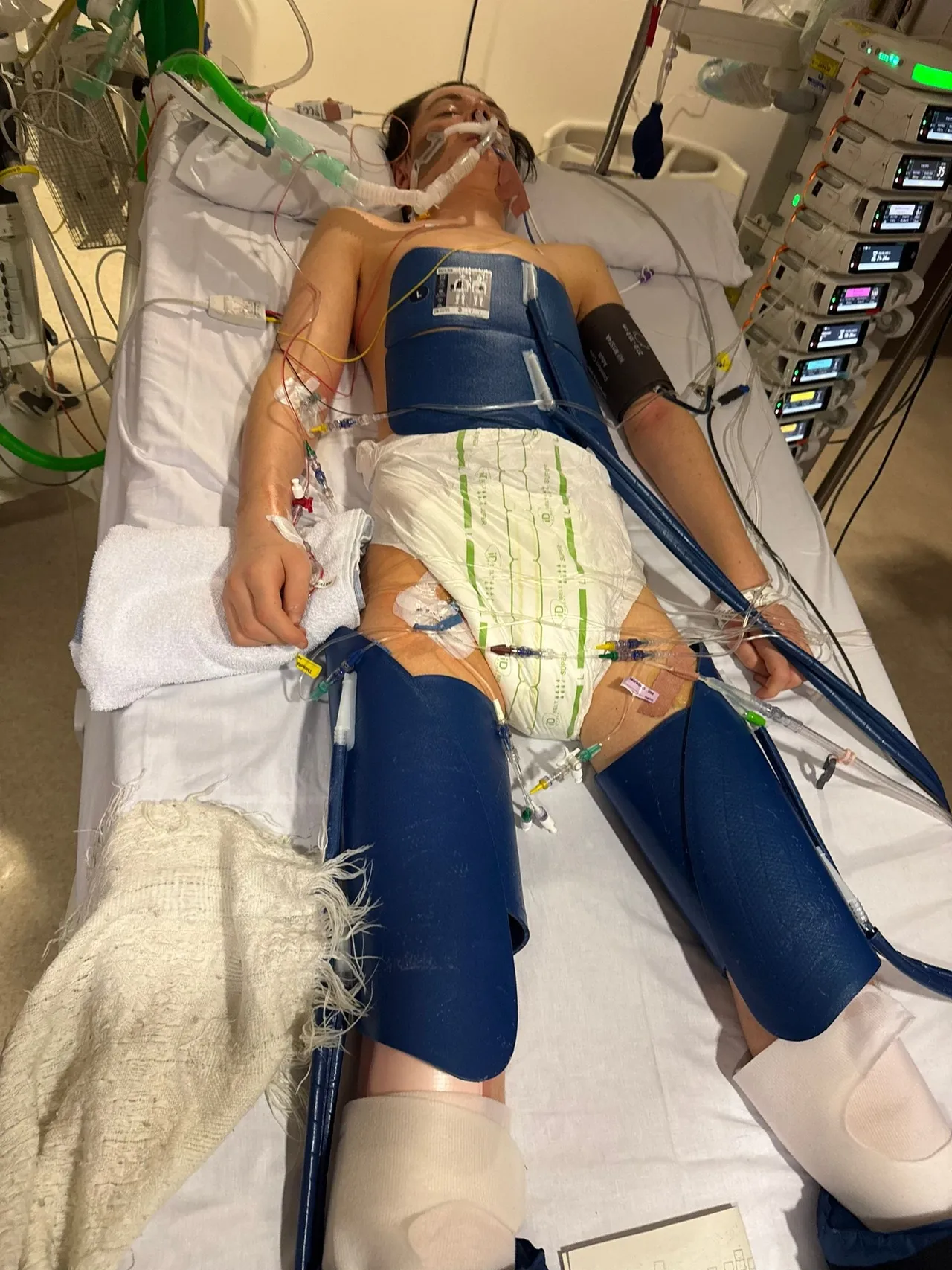 Carly said seeing Jacob in hospital was ‘surreal’