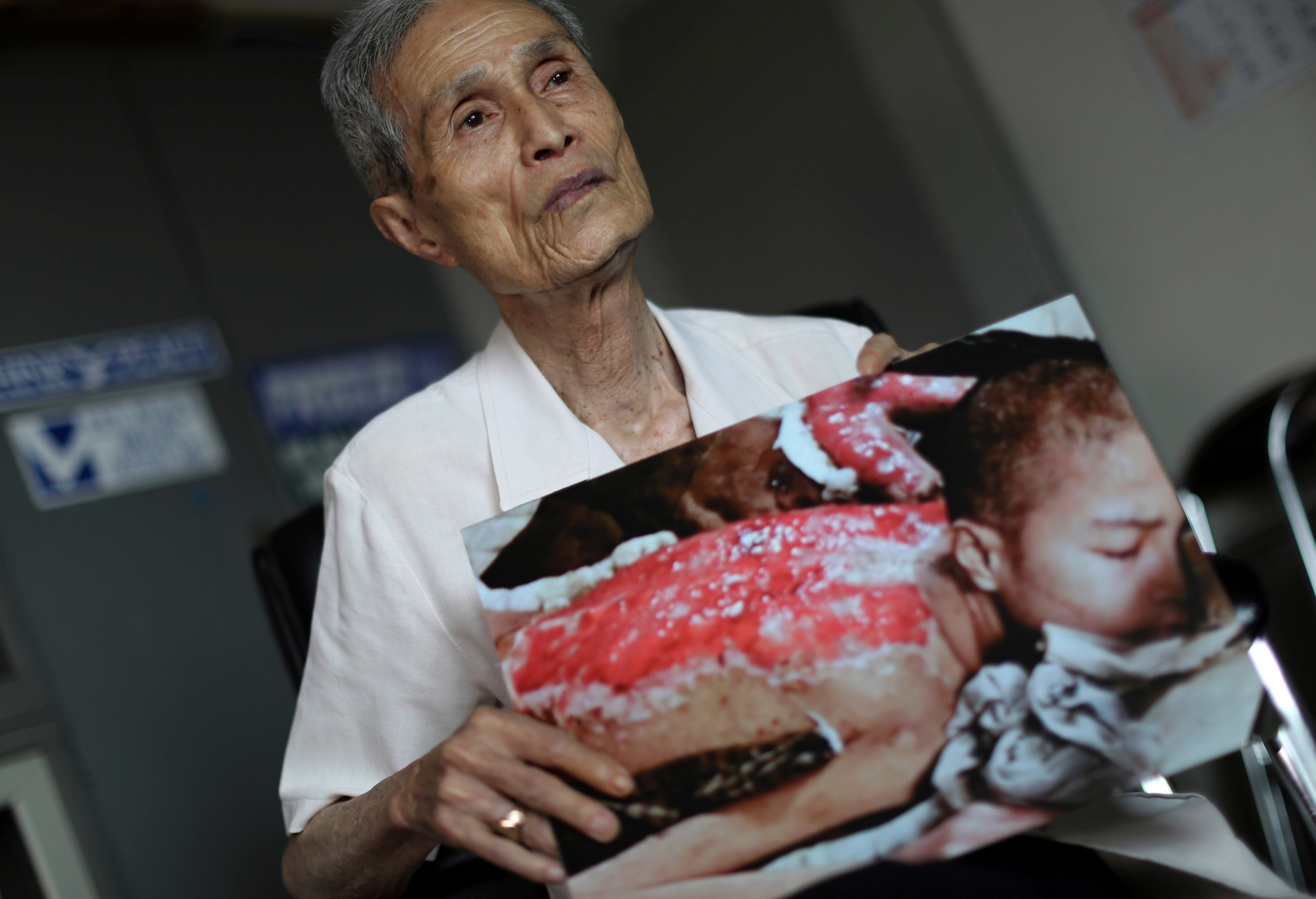 Japan Nagasaki Anniversary Scars Photo Gallery