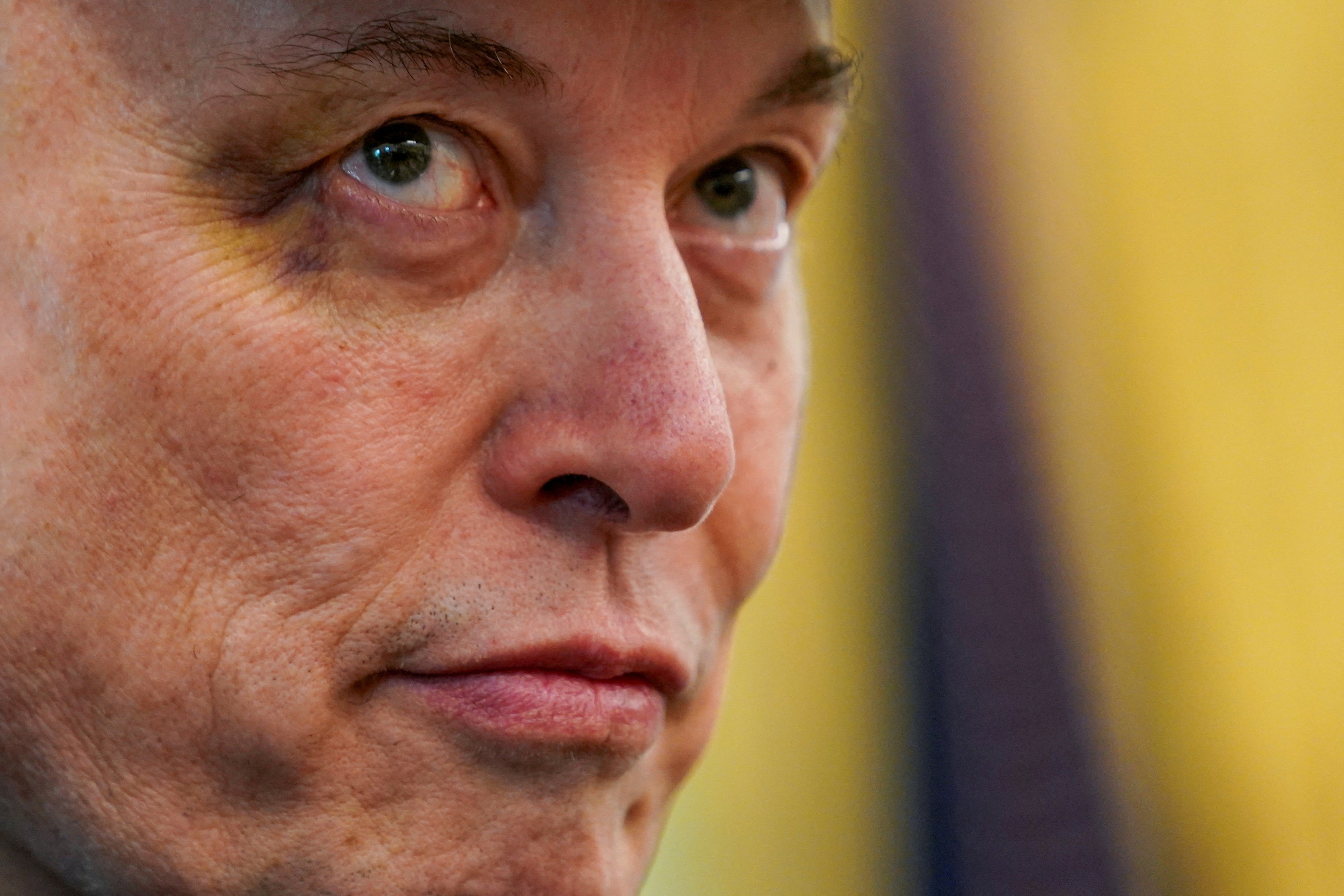 Elon Musk appeared in the Oval Office with a black eye earlier this year and claimed it was from his five-year-old son