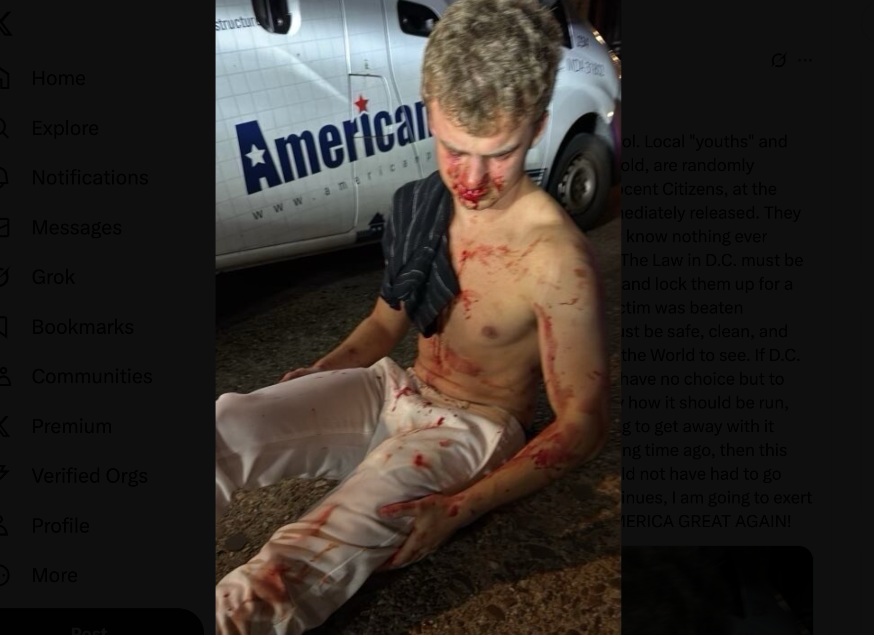 Edward 'Big Balls' Coristine after the attack in Washington D.C.