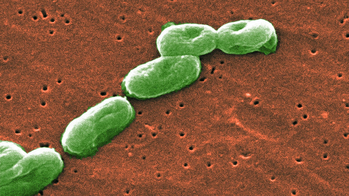 Burkholderia cepacia complex, also called B. cepacia or Bcc, is a group of bacteria that can cause infections in healthcare settings