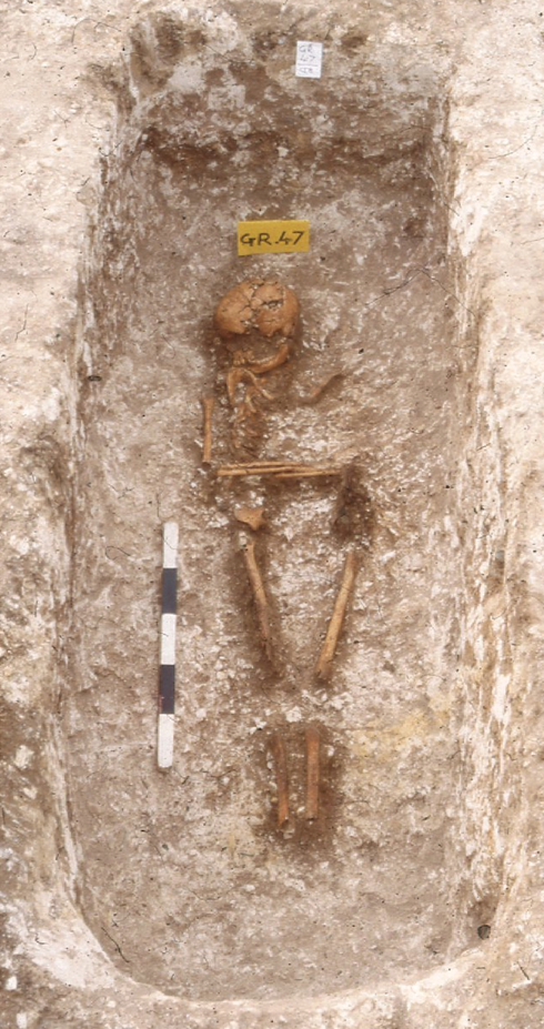 The Nigerian-ancestry girl's skeleton at Updown, Kent