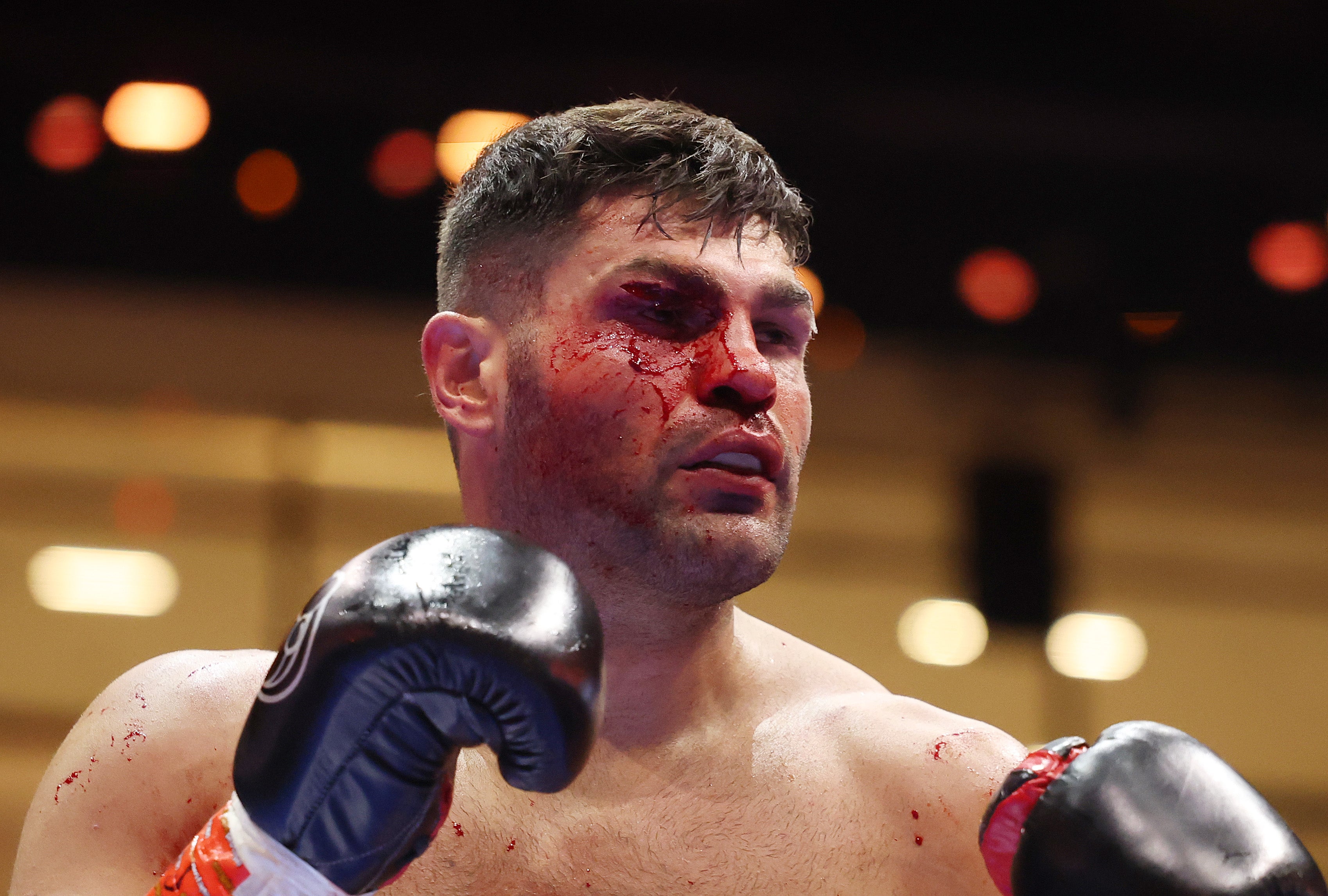 Filip Hrgovic sports a nasty gash over his right eye