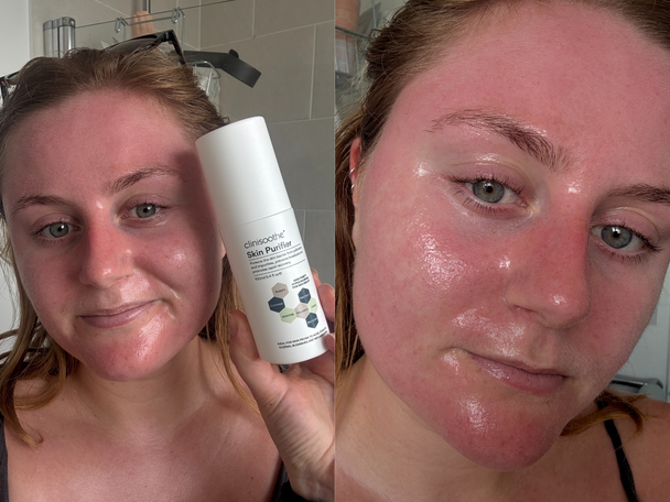 Indybest best hypochlorous acid spray review Clinisoothe+ skin purifier