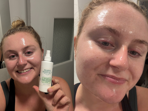 Indybest best hypochlorous acid spray review Mario Badescu repairing facial spray with hypochlorous acid