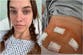 Barbara Palvin shares secret health battle after undergoing surgery