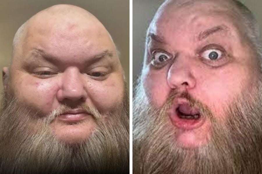 John Crawley, the comedian known as KingBeard X on TikTok, died Monday following hospitalization for troubled breathing
