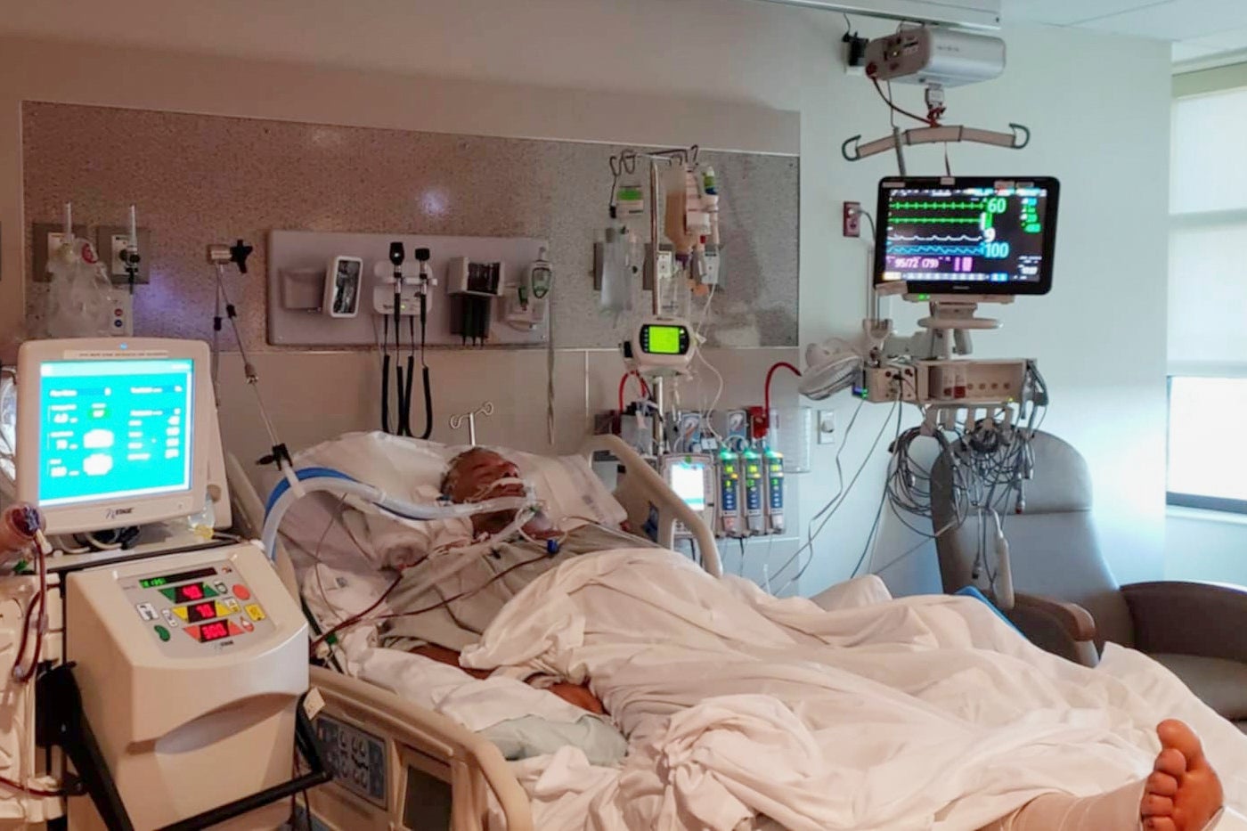 Bernie Stewart was placed in a coma at a hospital in Pensacola, Fla., shortly after the start of an August 2019 Vibrio infection