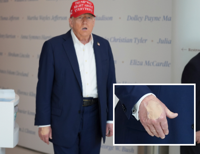 Trump was spotted wearing hand makeup again on Friday