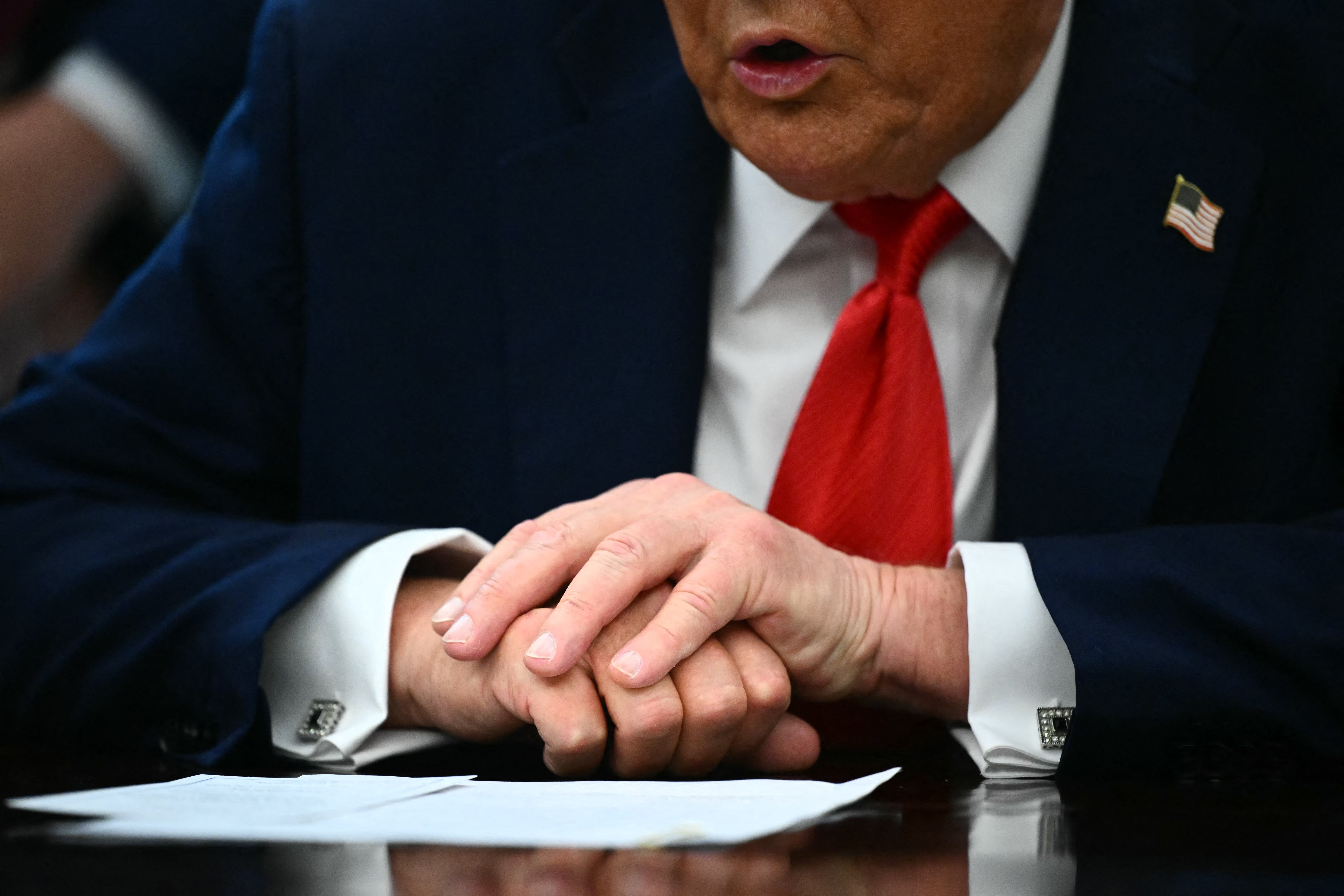 Trump kept his left hand over his right hand while speaking with reporters in the Oval Office on Monday – later, a bruise could be seen on the back of his right hand