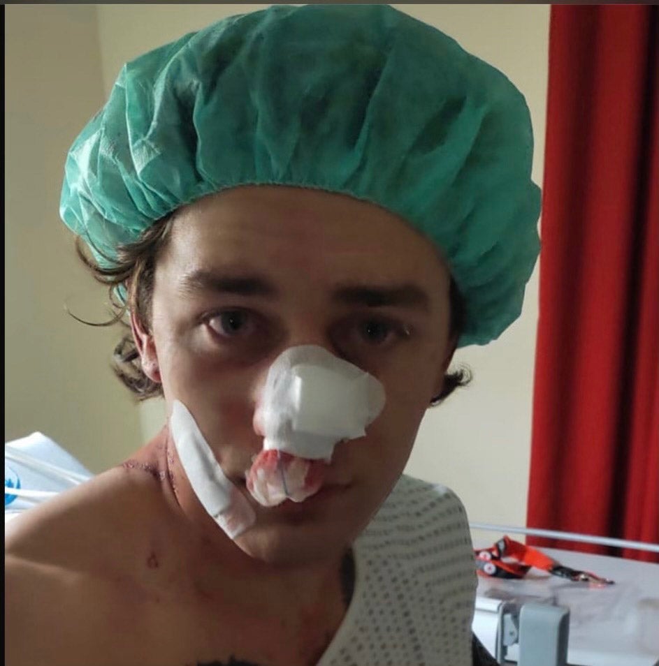 American John Rudat claims there is an ‘immigration problem’ in Europe and Germany after he was attacked on a Dresden tram