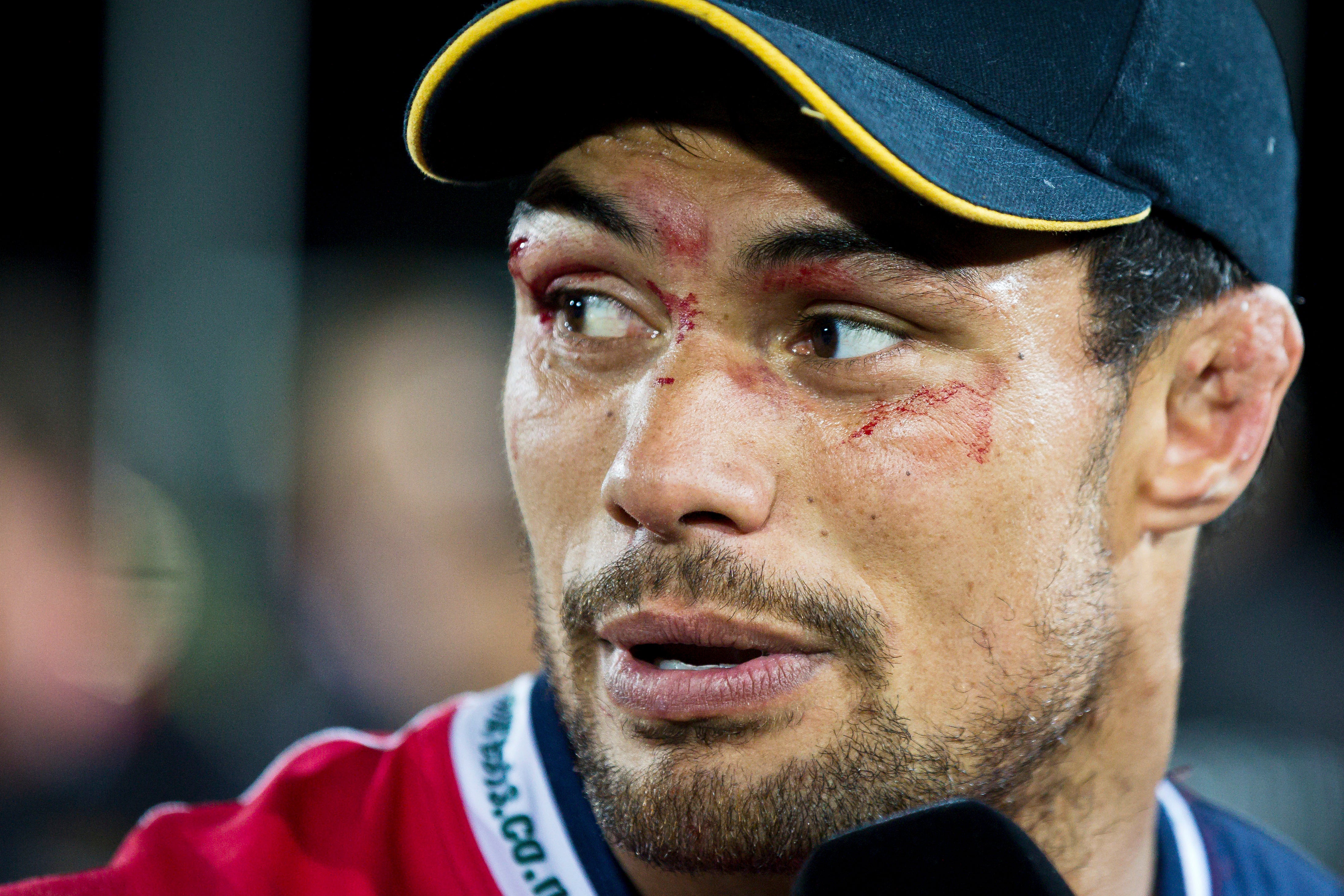 Shane Christie reacts following his game for the Tasman Makos in Nelson, New Zealand, Oct. 18, 2014