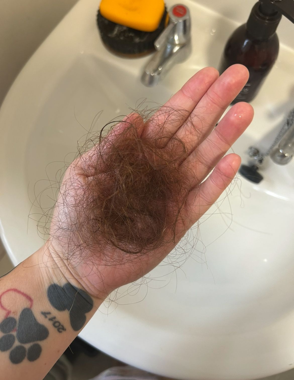 At the worst point, Ms Griffiths-Bowen was picking up a handful of hair while taking a shower