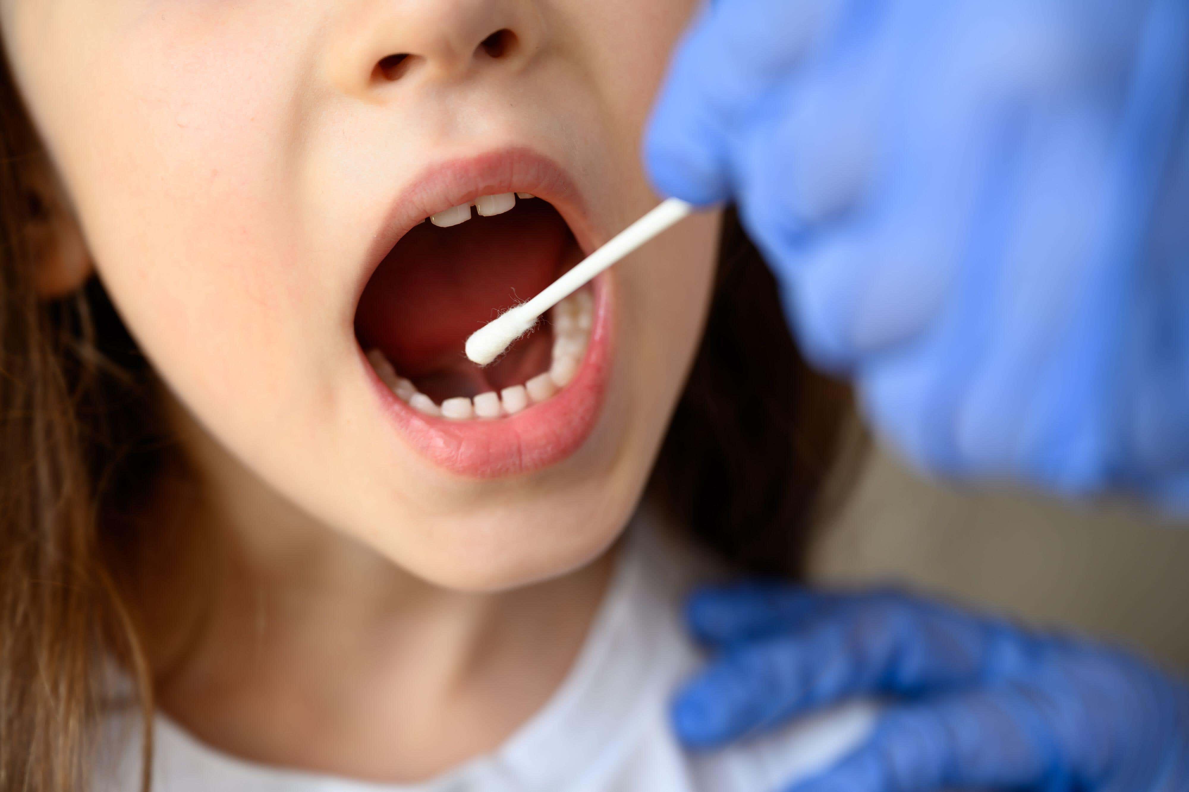 The study found cheek swabs revealed changes in the youngsters up to five years before they were diagnosed (Alamy/PA)