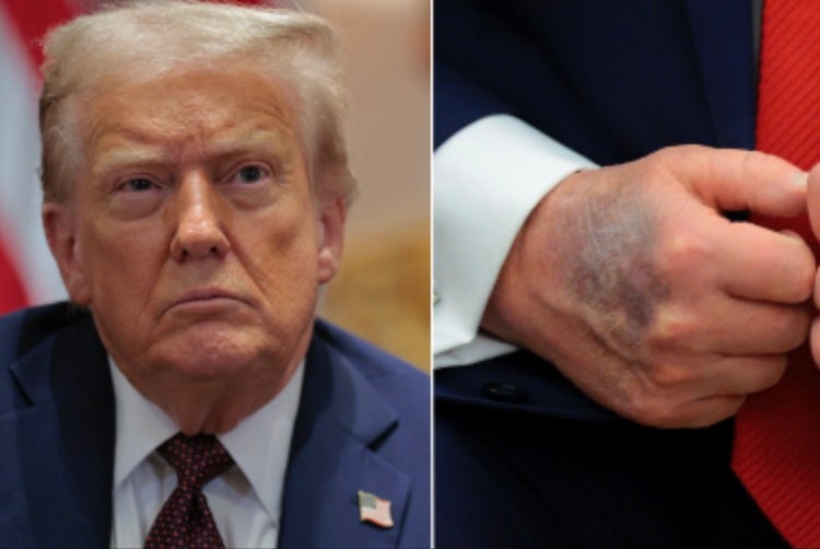 America is split on whether Trump’s health and age are impacting his ability to serve as president